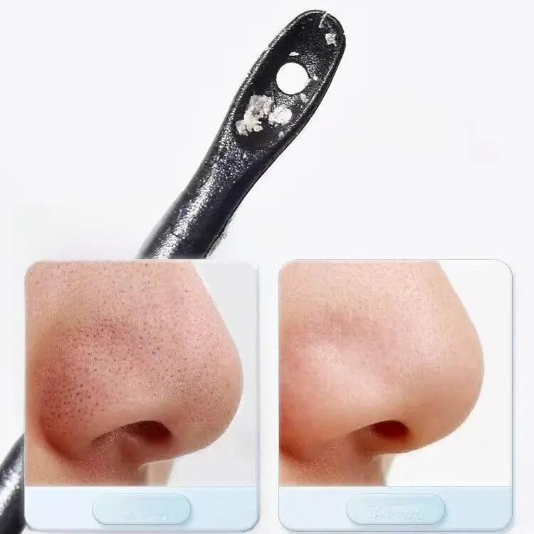 Acne Pimple Cleaning Cotton Swabs