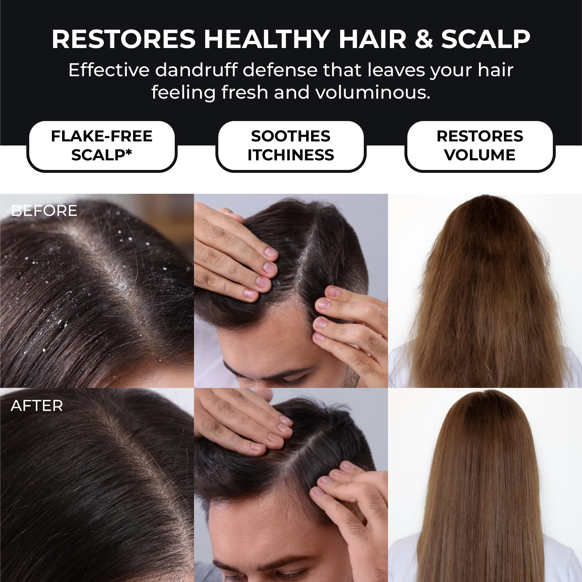 ABERA Anti-Dandruff Shampoo – Stronger Hair & Healthier Scalp | Nourishes & Supports Hair Growth | 6.67 fl oz