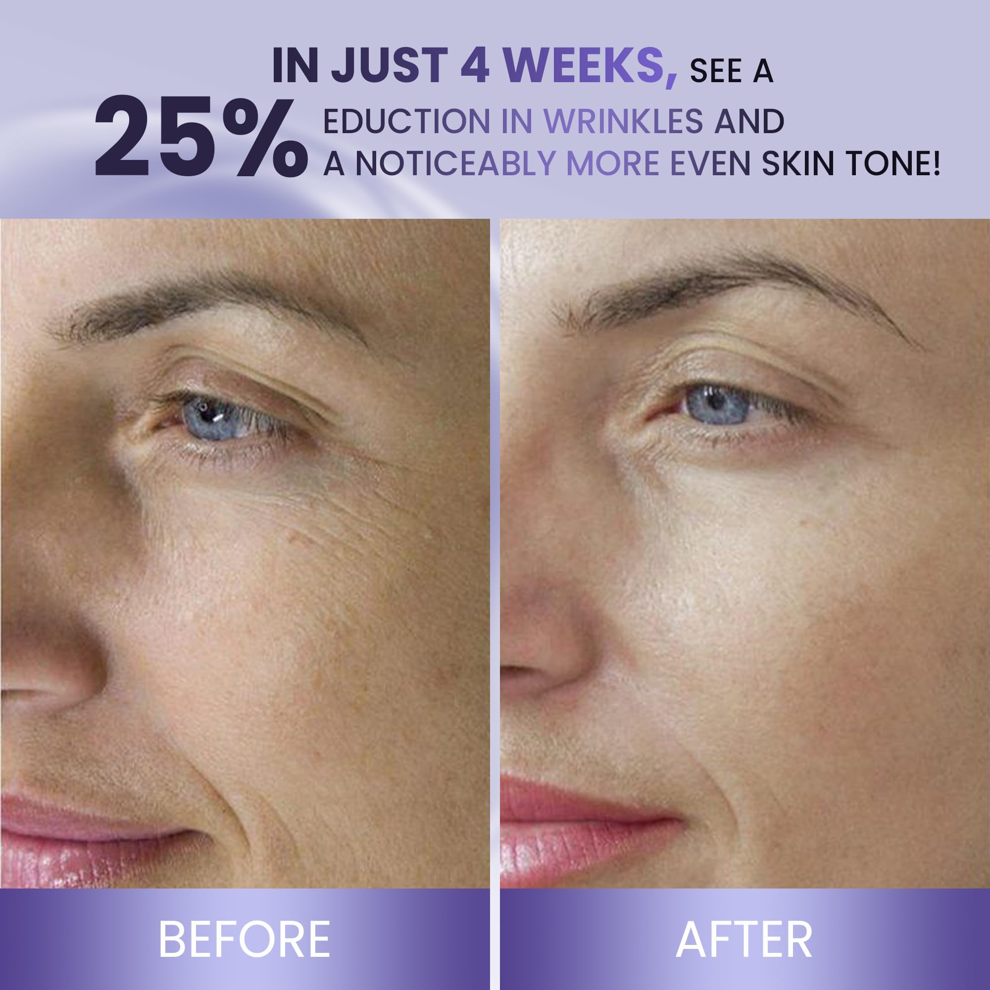 ABERA Belani Retinol Night Cream with Collagen & Hyaluronic Acid – Anti-Wrinkle, Fine Line Smoother, Hydrating Facial Moisturizer for Women (1.01 Fl Oz)