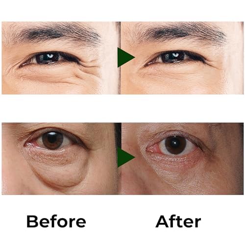 Abera Eye Roller Serum – Mint, Vitamin C & Peptides for Puffiness & Dark Circles | 0.34 fl oz