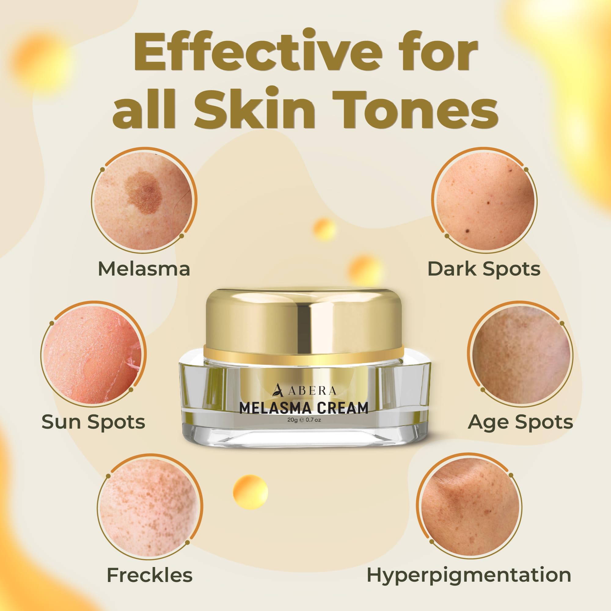 ABERA Melasma Cream - Dark Spot Corrector for Freckles & Sun Spots