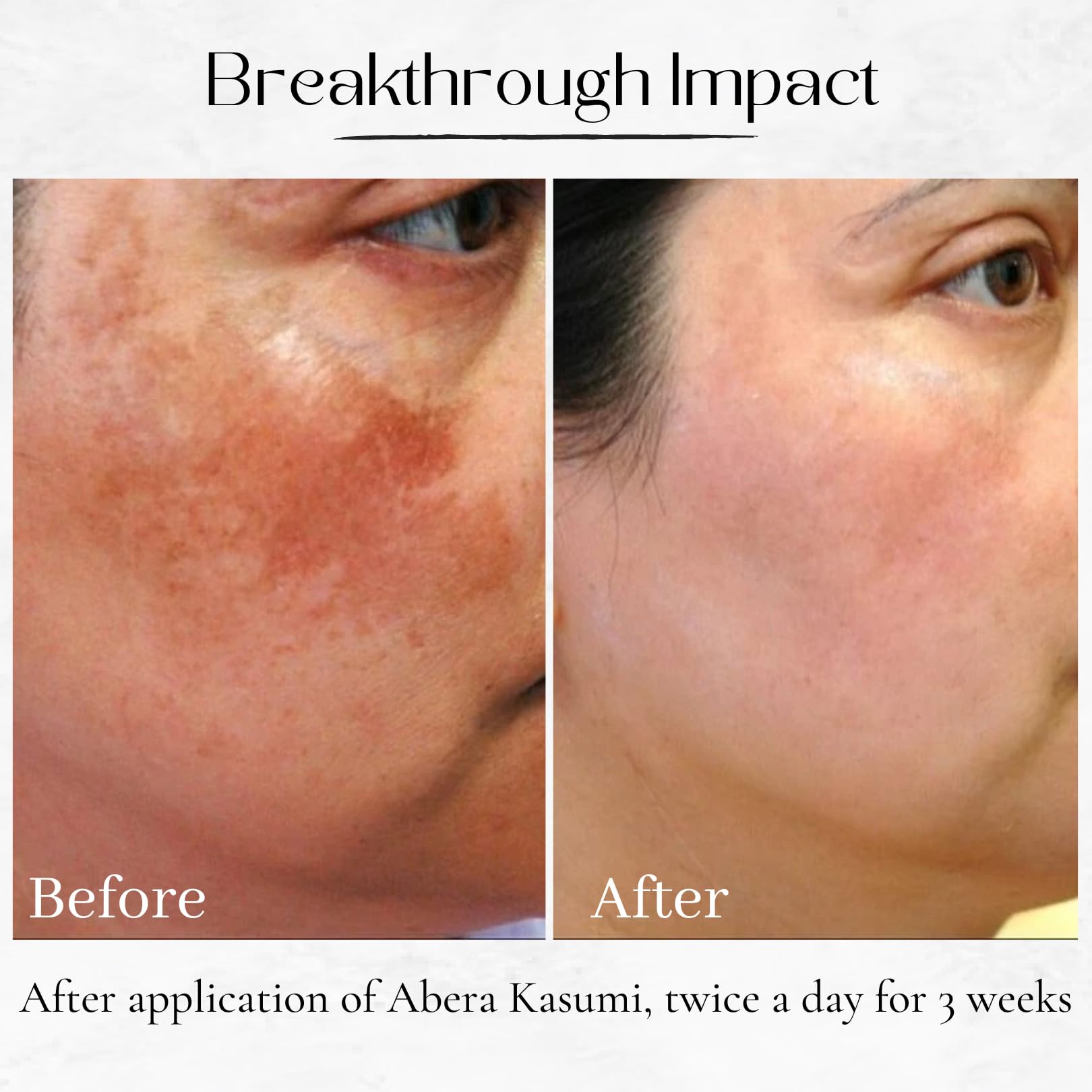 ABERA Kasumi Glowing Cream – Niacinamide + HA, Melasma & Dark Spot Support (0.7 oz)