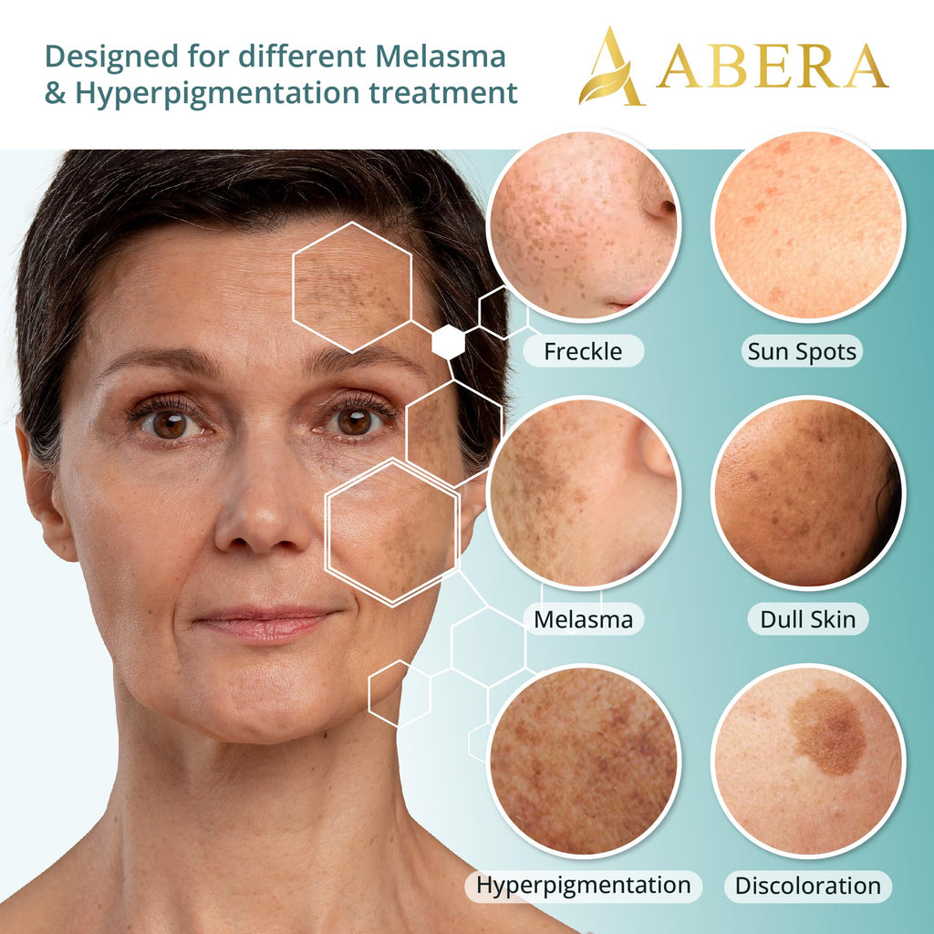 ABERA Melasma Serum – Melanin Correcting Facial Serum with Niacinamide & HA (0.68 fl oz)