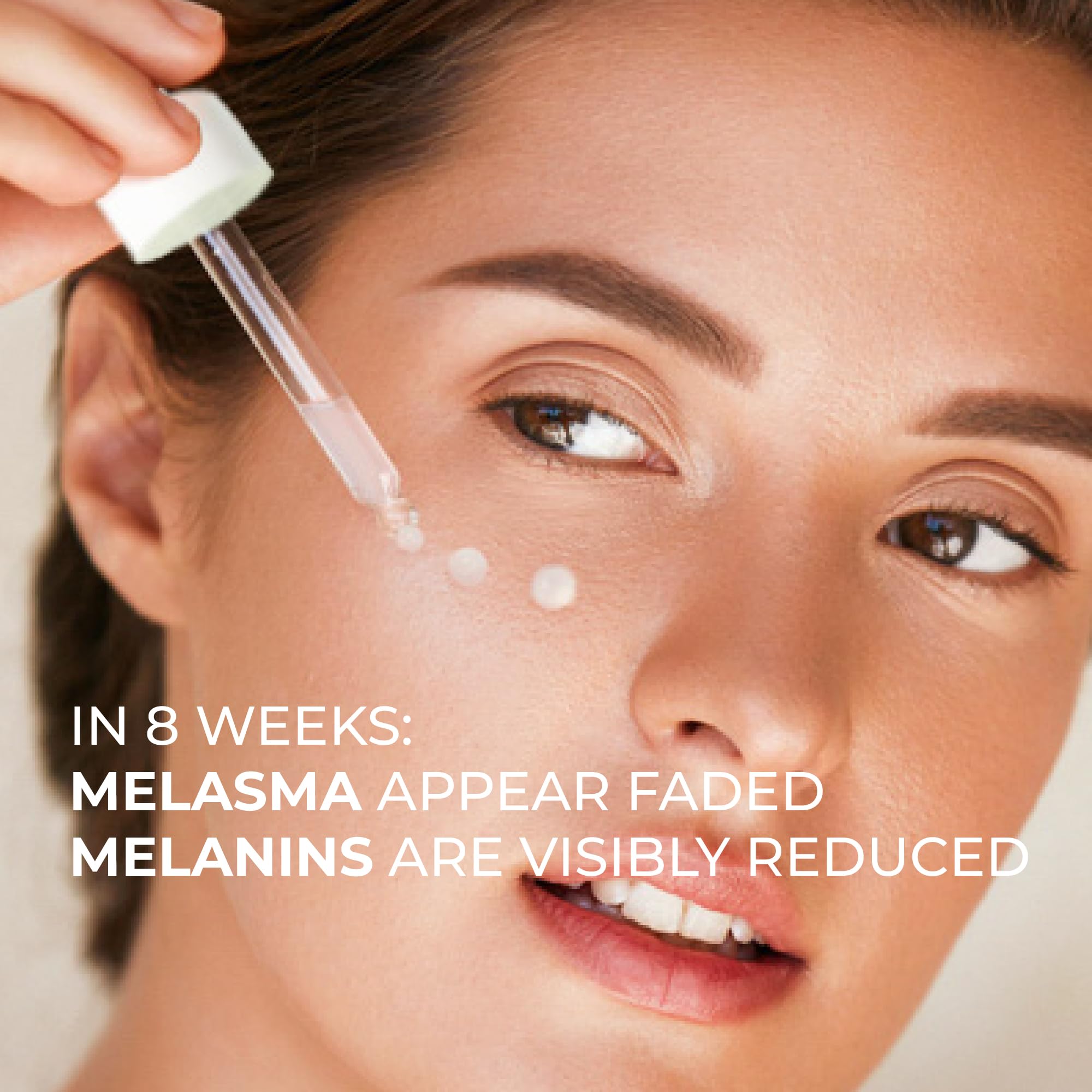 ABERA Melasma Serum – Melanin Correcting Facial Serum with Niacinamide & HA (0.68 fl oz)
