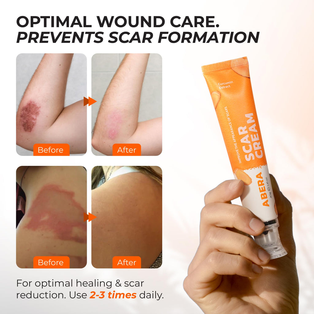 ABERA Scar Cream Upgrade – Skin Regeneration & Repair Cream (1.41 oz per item)