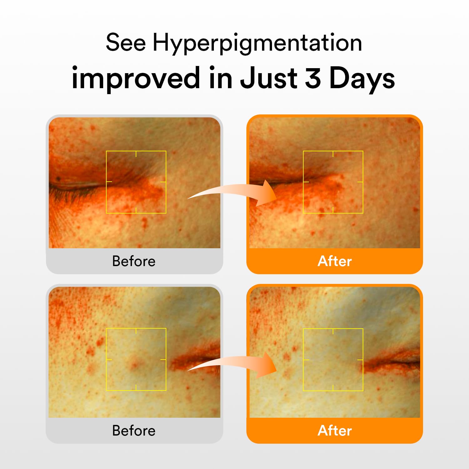 Abib Glutathiosome Dark Spot Serum Vita Drop 1.69 fl oz | Korean Skincare for Hyperpigmentation & Sensitive Skin
