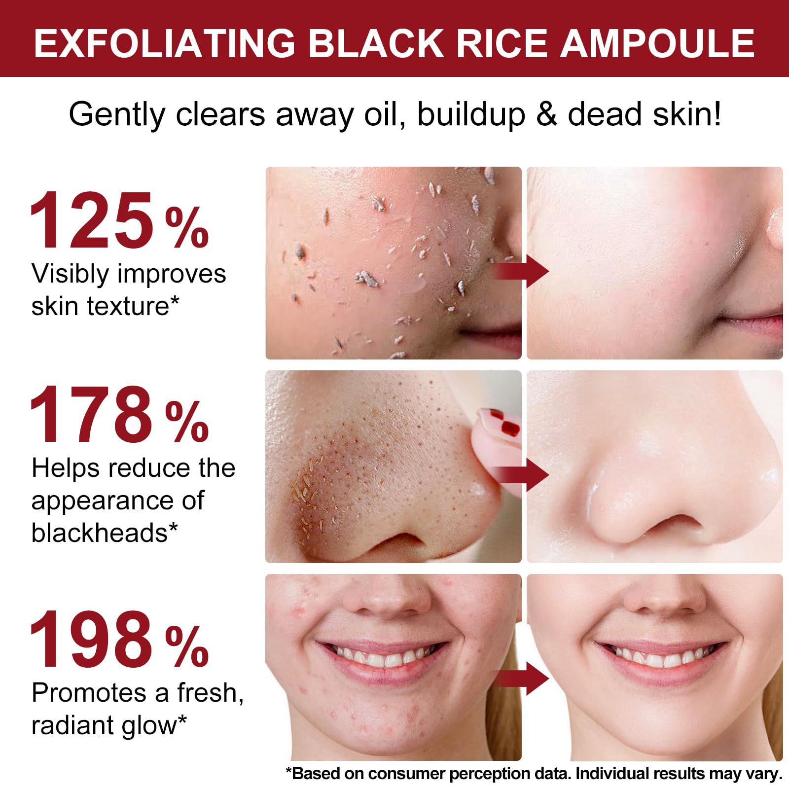ABOUME Peel Shot Duo White & Black Rice Exfoliant – Gentle Rice Exfoliator for Face & Body (2 x 100ml)