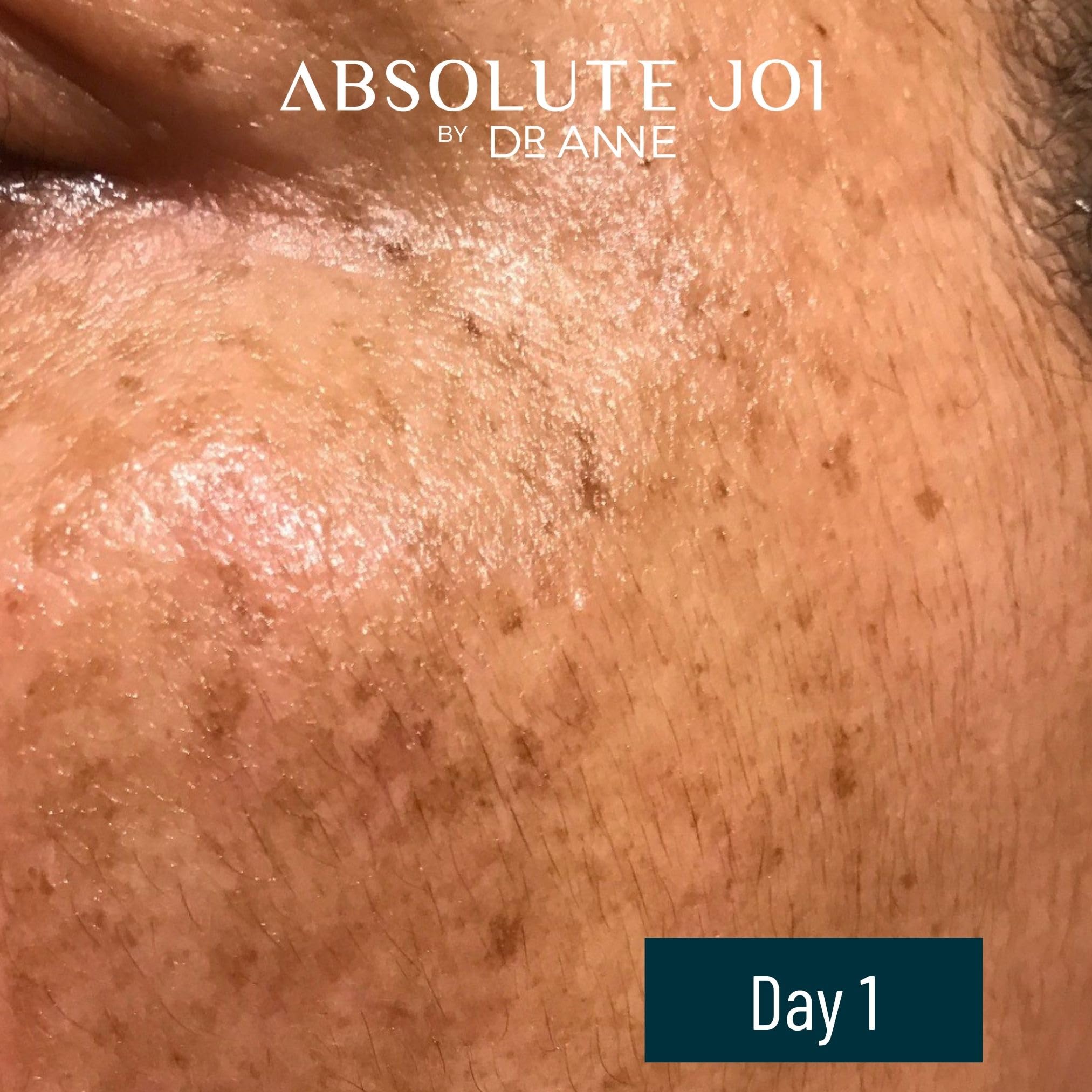 AbsoluteJOI Retinol Oil Serum with Vitamin C – Night Oil for Sensitive Skin (Unscented, 1 oz)