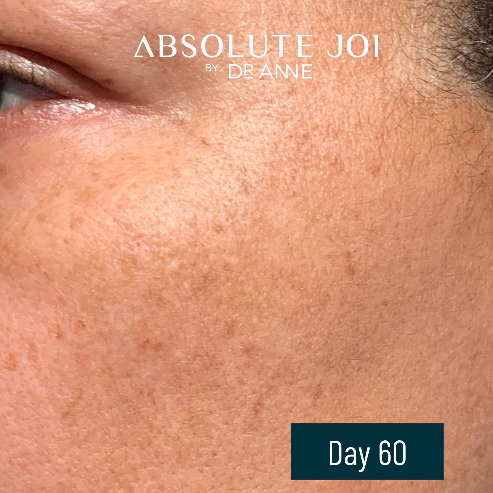 AbsoluteJOI Retinol Oil Serum with Vitamin C – Night Oil for Sensitive Skin (Unscented, 1 oz)