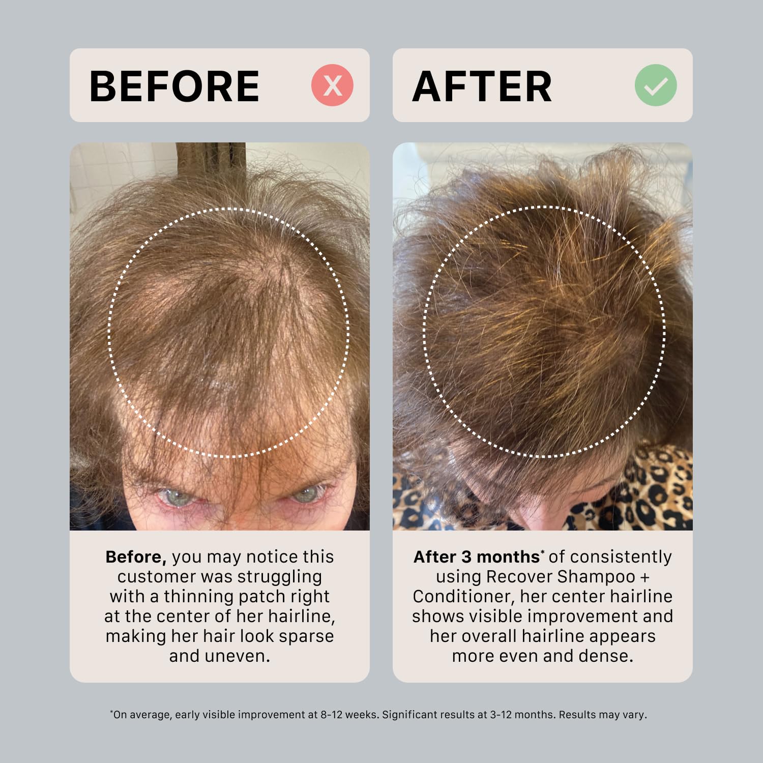 ACTIIV Recover Thickening Conditioner – Hydrates, Strengthens, Color-Safe, 16 oz