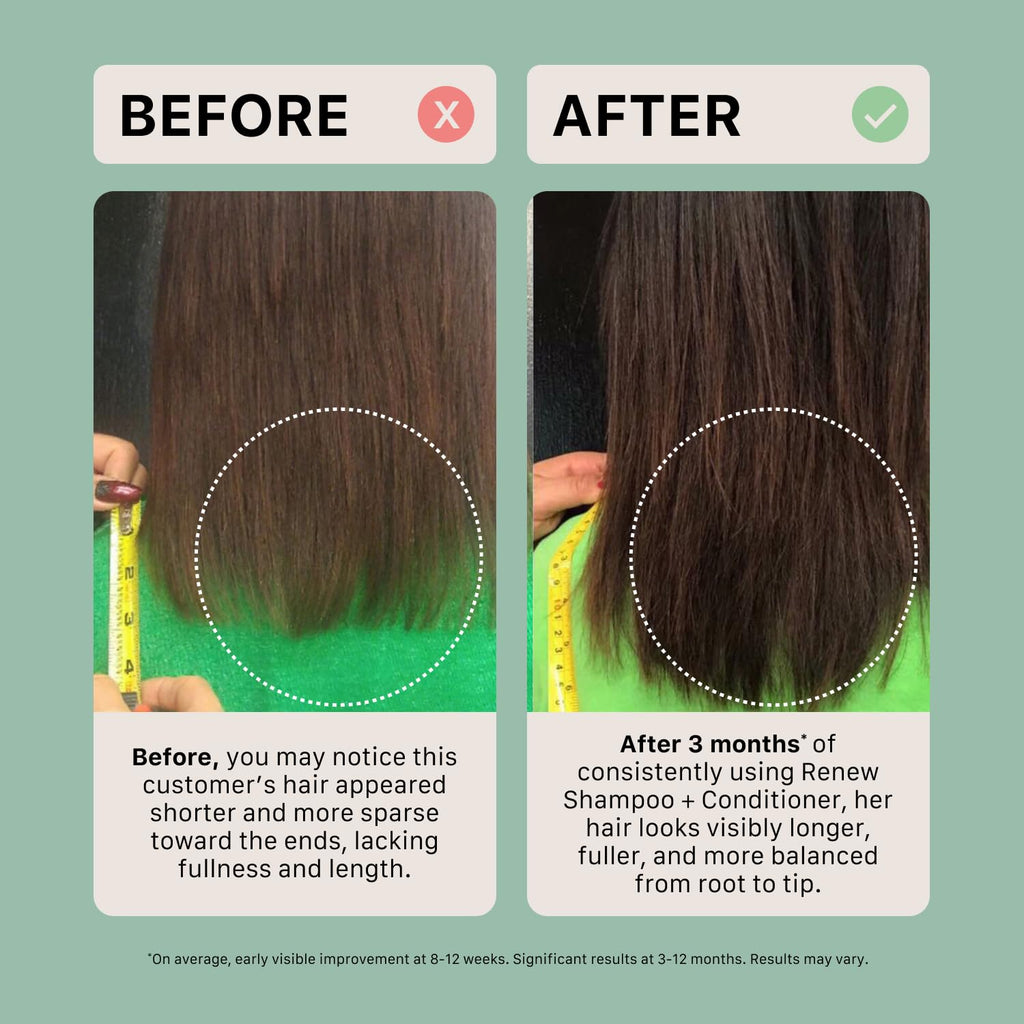 ACTIIV Renew Healing Conditioner (Unisex) – Hydrates, Strengthens, Plant-Based