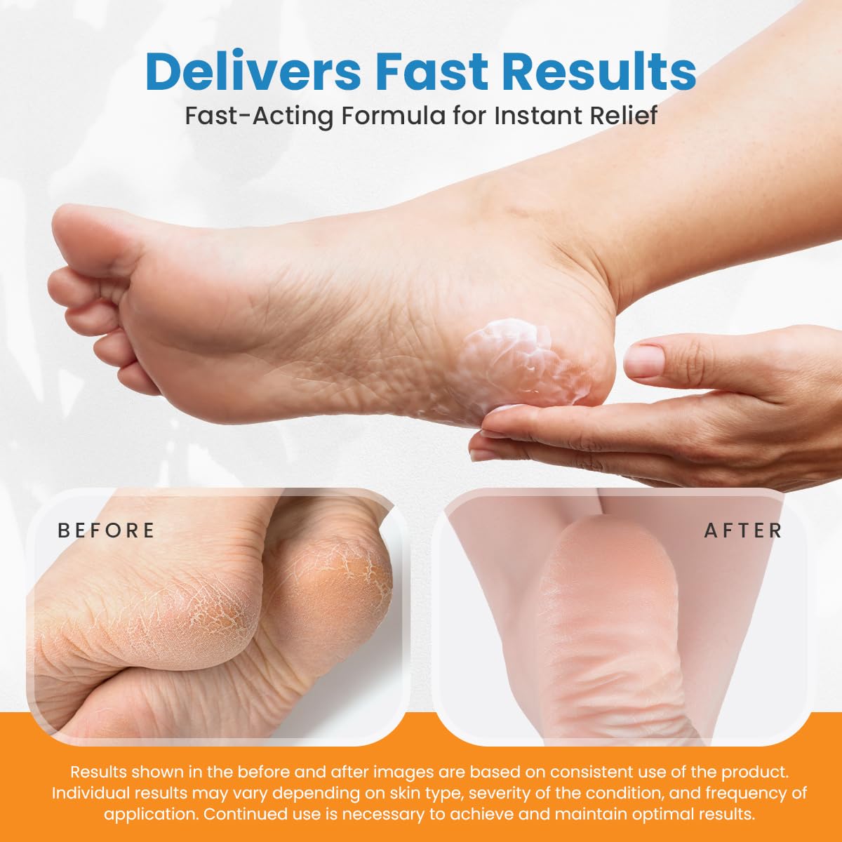 ActivLife RevitaDerm 4D Urea Cream 40% for Feet – Fast-Absorbing, Fragrance-Free (4oz)