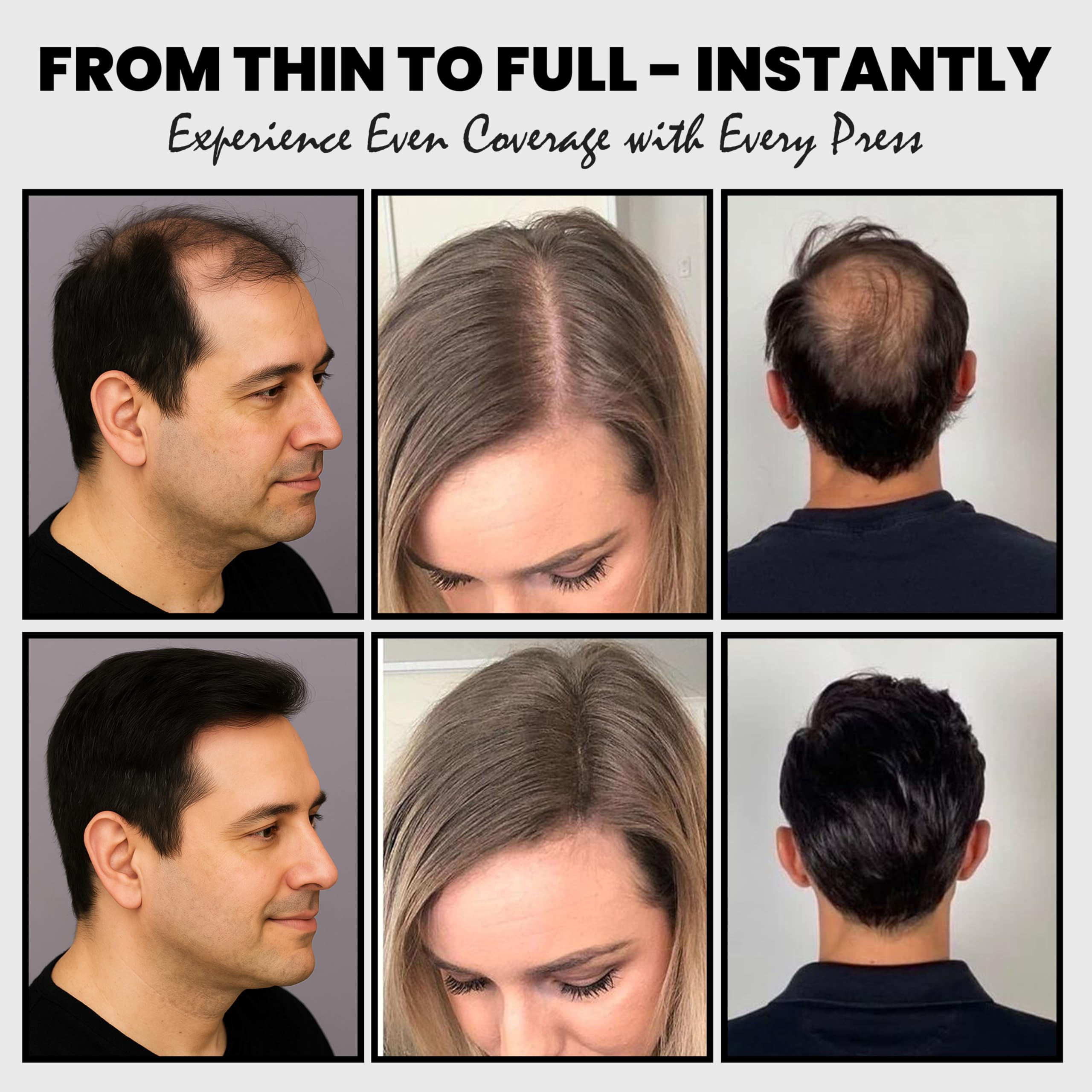 Adglamful Hair Fibers for Thinning Hair — Undetectable Coverage (Black, 30g)