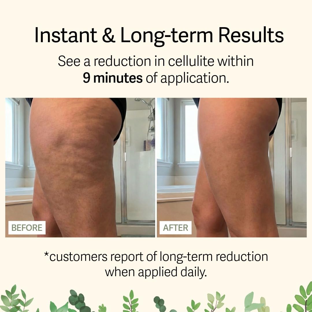 Adonia Organics LegTone – Organic Cellulite Cream for Firming & Smoothing
