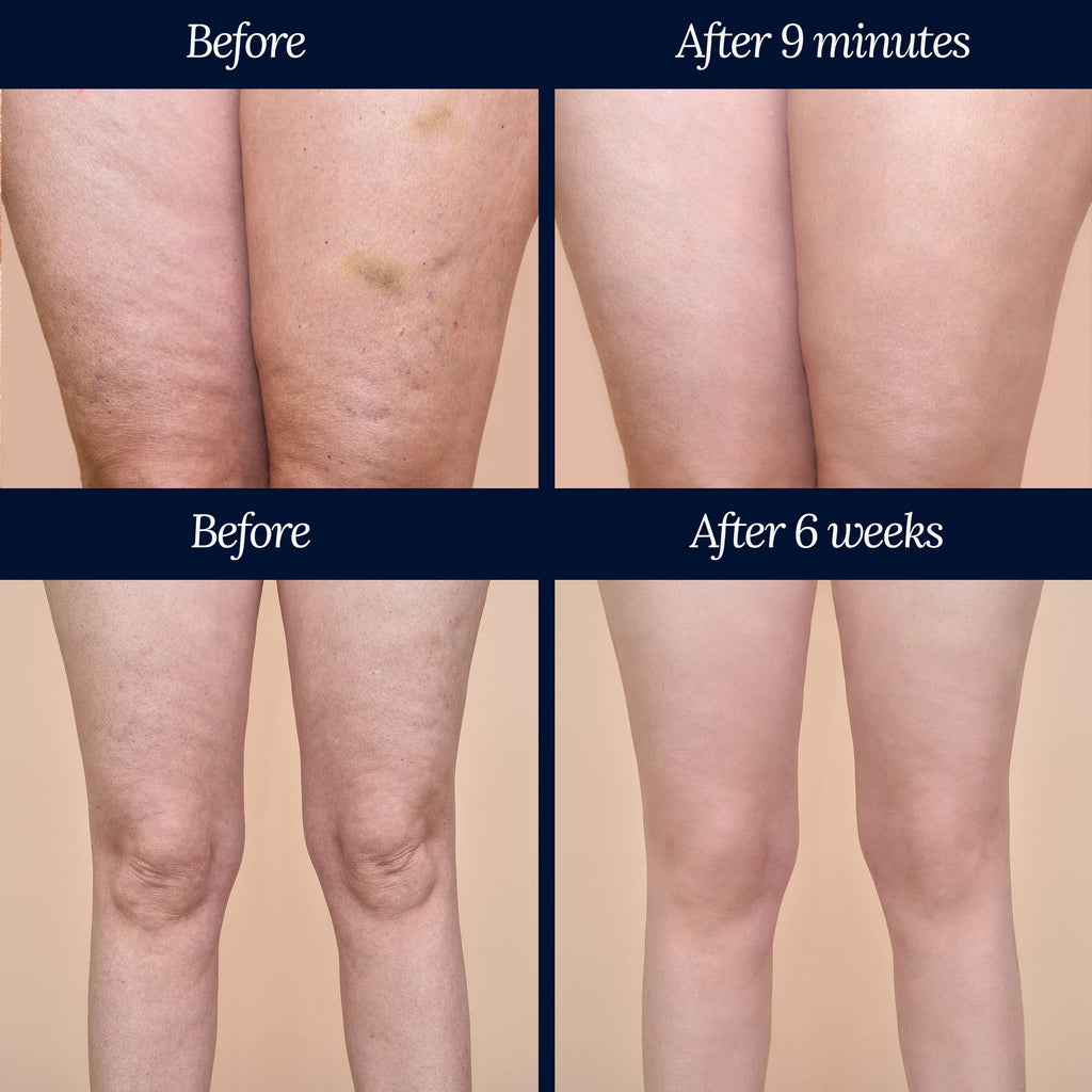 Adonia Organics LegTone – Organic Cellulite Cream for Firming & Smoothing