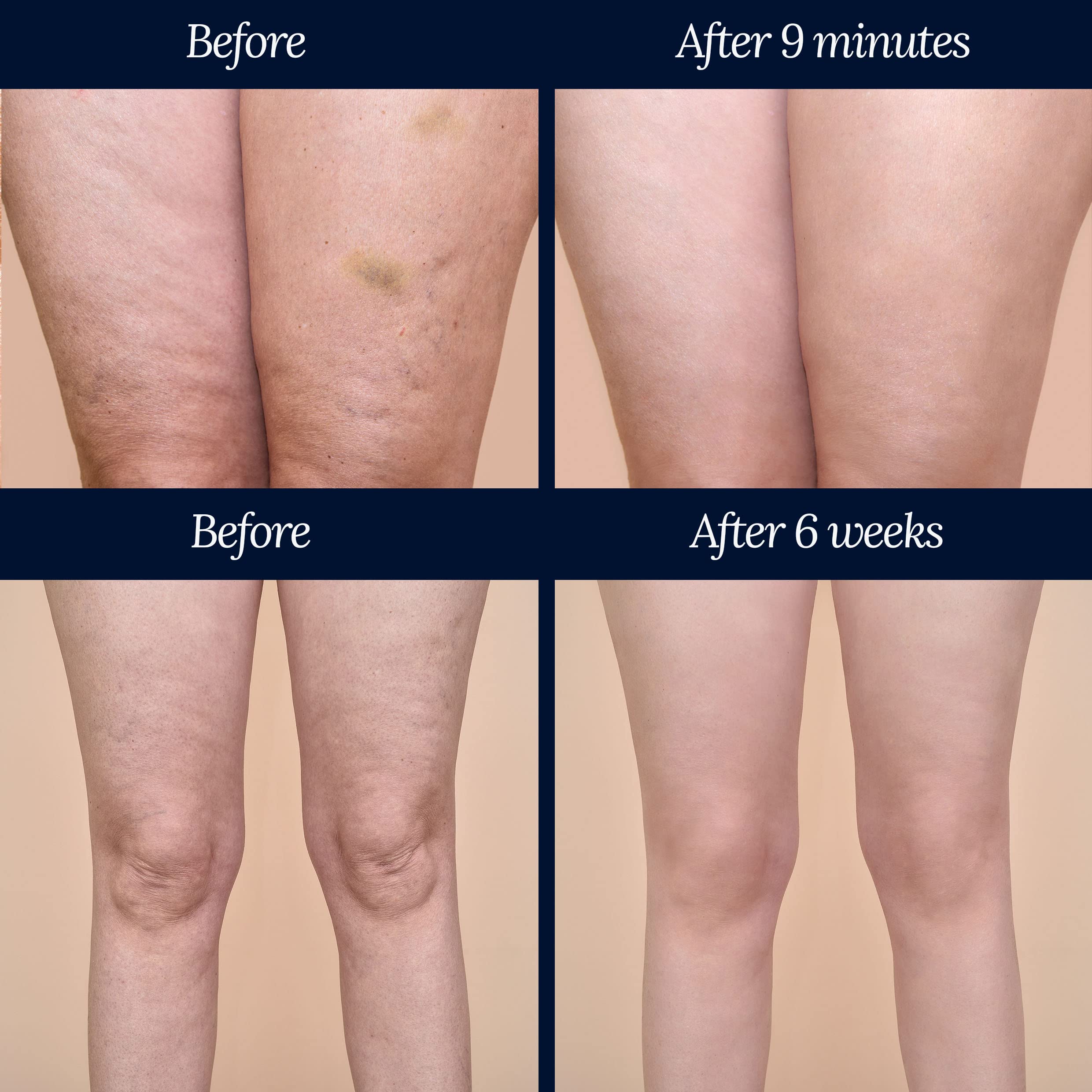 Adonia Organics LegTone – Organic Cellulite Cream for Firming & Smoothing