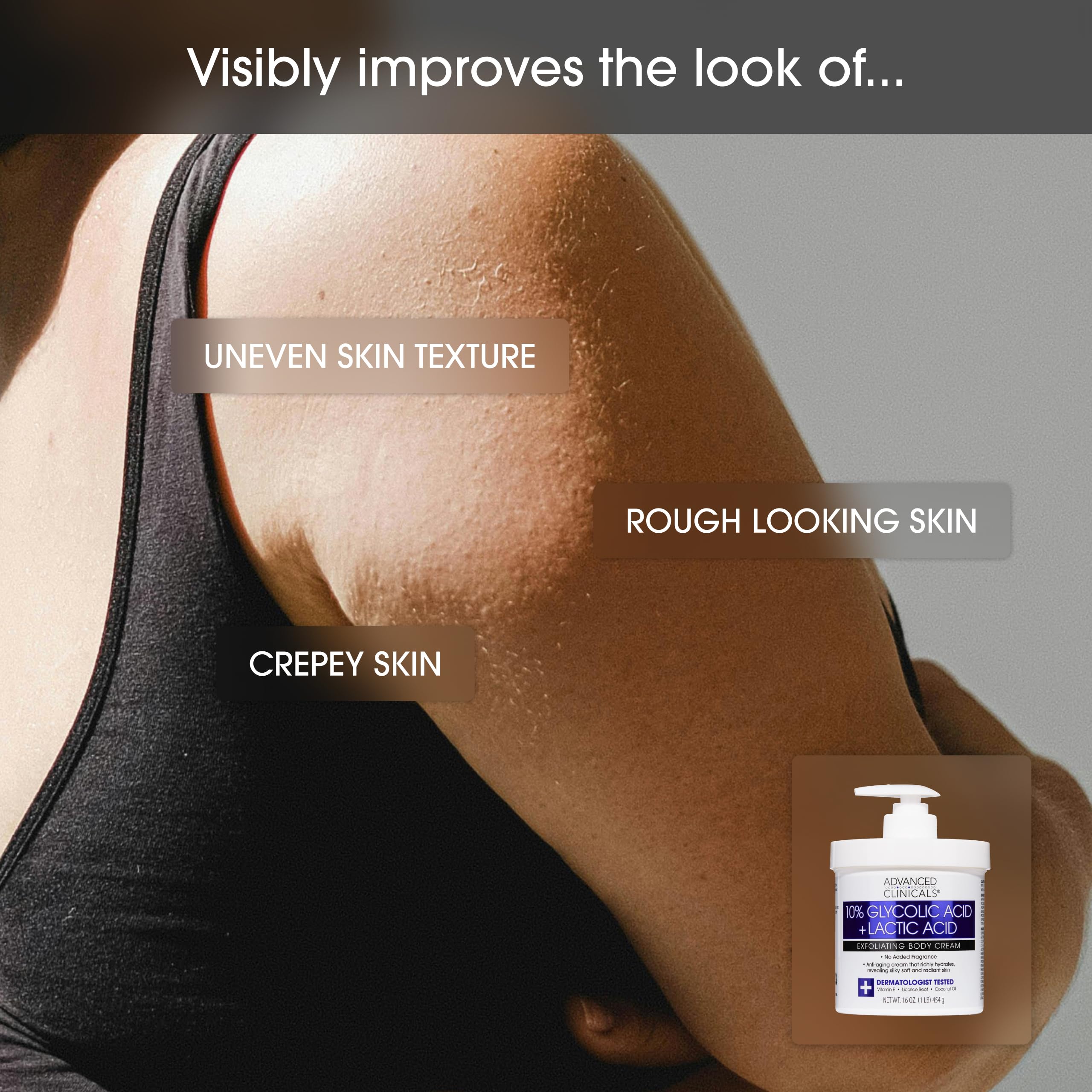 Advanced Clinicals Retinol Body Cream + 10% Glycolic-Lactic Lotion Set