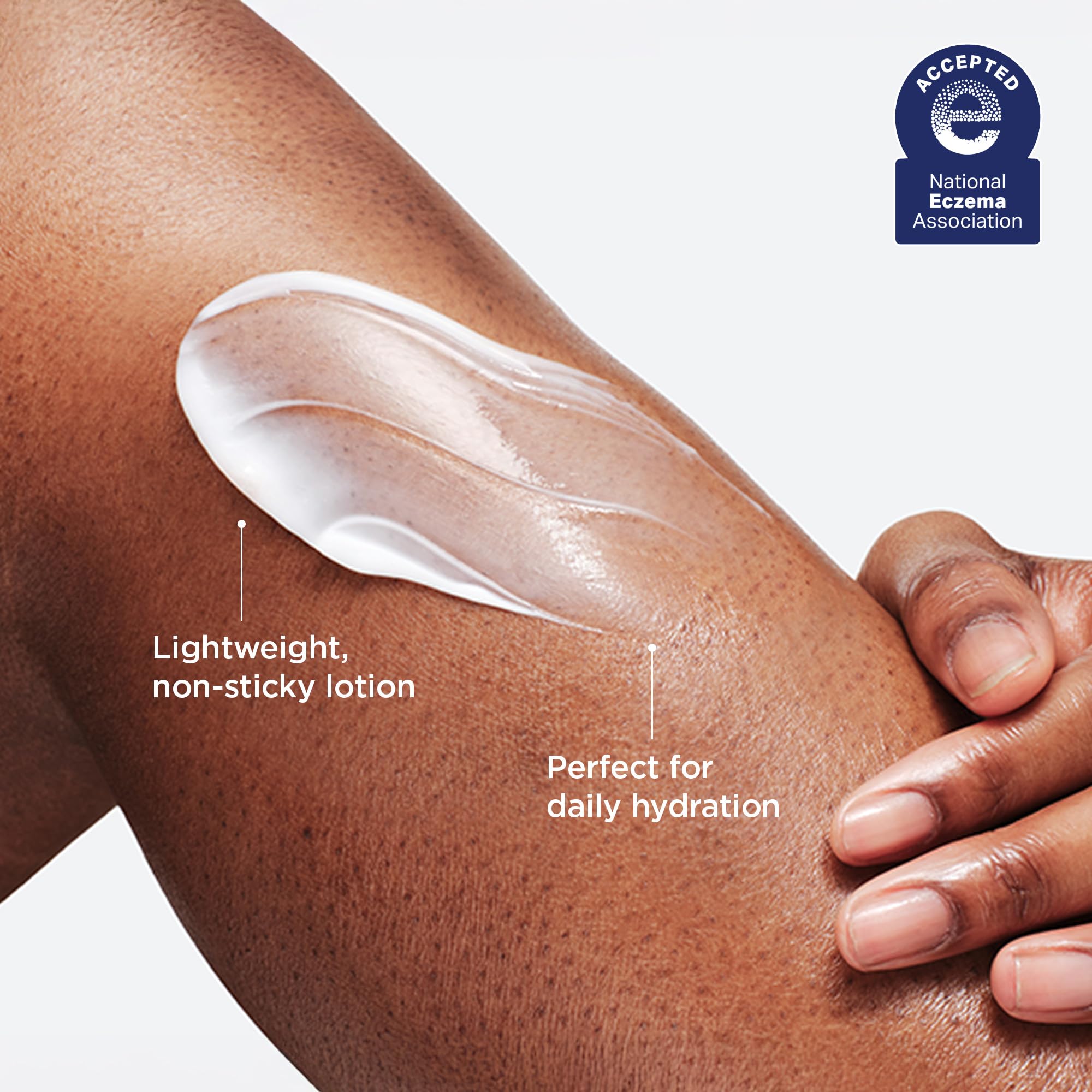 AESTURA ATOBARRIER365 Ceramide Body Lotion | Fast-Absorbing, Fragrance-Free for Dry & Sensitive Skin | 400 mL