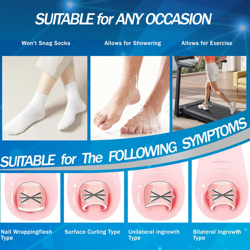 Aethyron Ingrown Toenail Corrector | Upgraded 6-Angle Titanium Alloy Kit (9 Pcs)