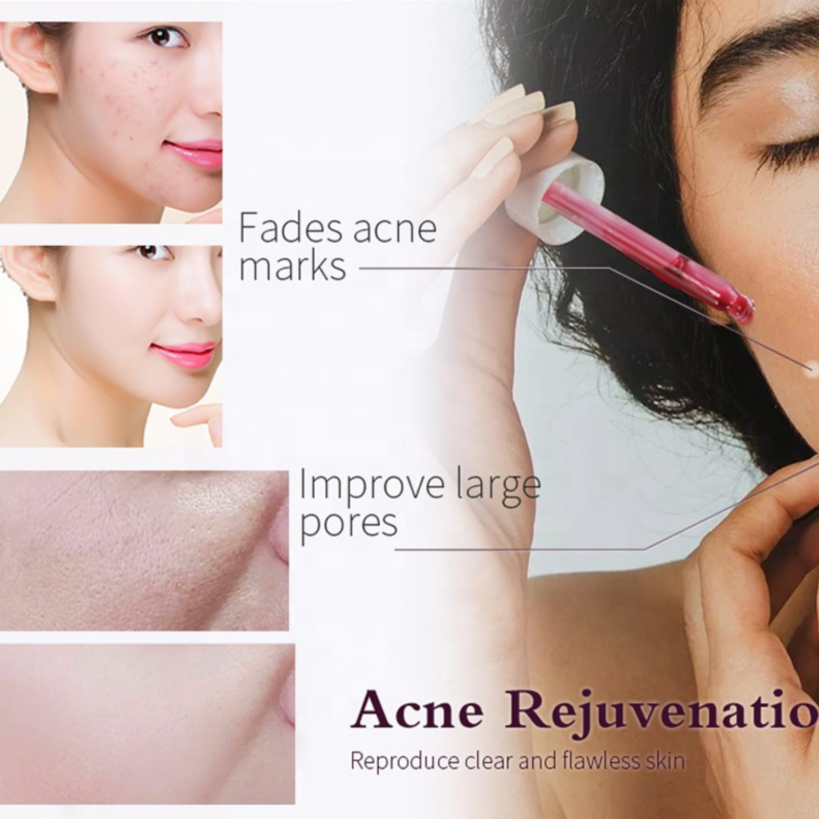 AHA 30% + BHA 2% Peeling Solution — At-Home Facial Exfoliant for Large Pores & Fine Lines (2 x 1.0 fl oz)