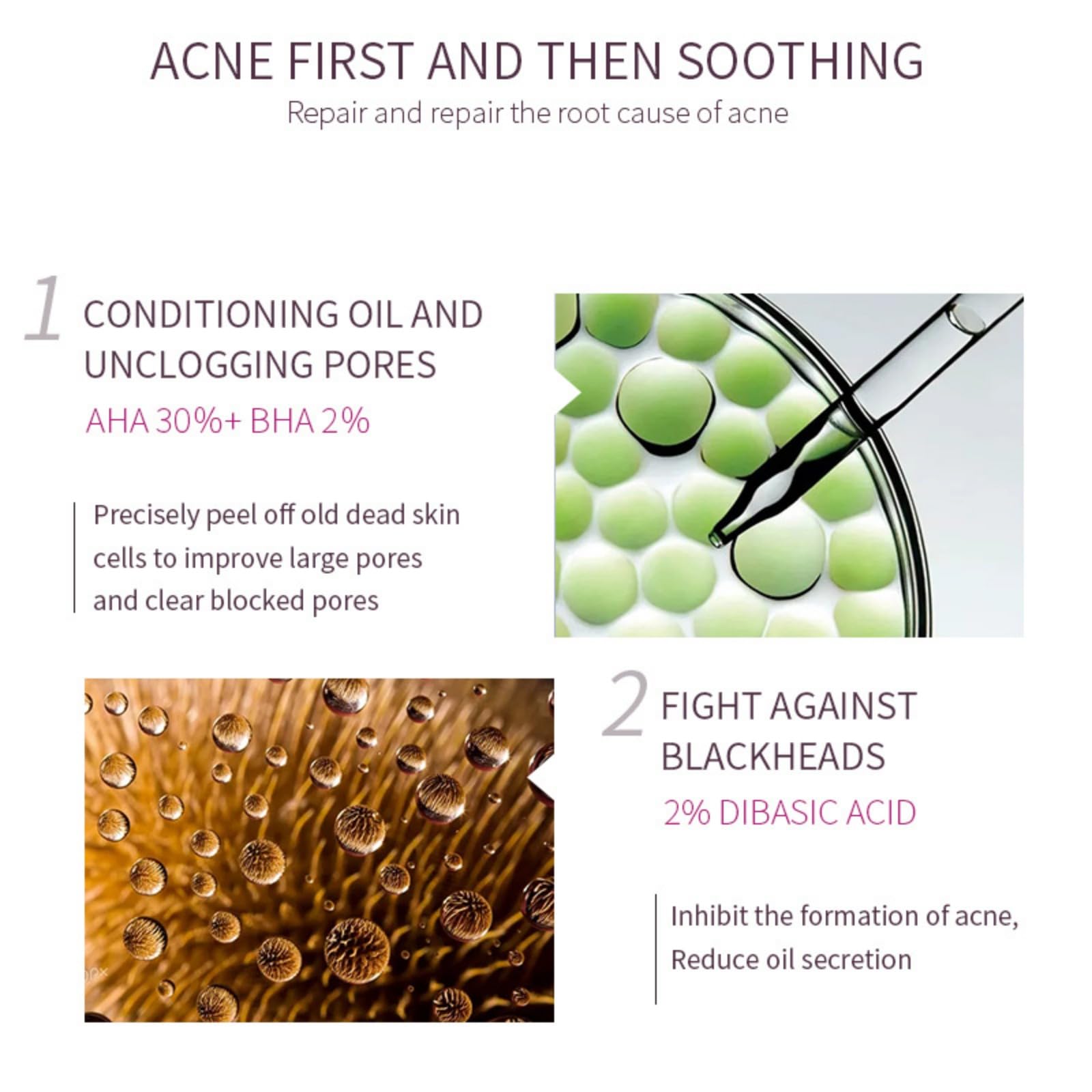 AHA 30% + BHA 2% Peeling Solution — At-Home Facial Exfoliant for Large Pores & Fine Lines (2 x 1.0 fl oz)