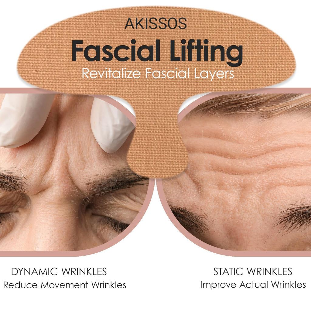 Akissos Forehead Wrinkle Patches Overnight – Deep Fascia Lift & 11-Line Coverage