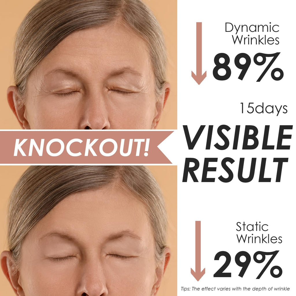 Akissos Forehead Wrinkle Patches Overnight – Deep Fascia Lift & 11-Line Coverage