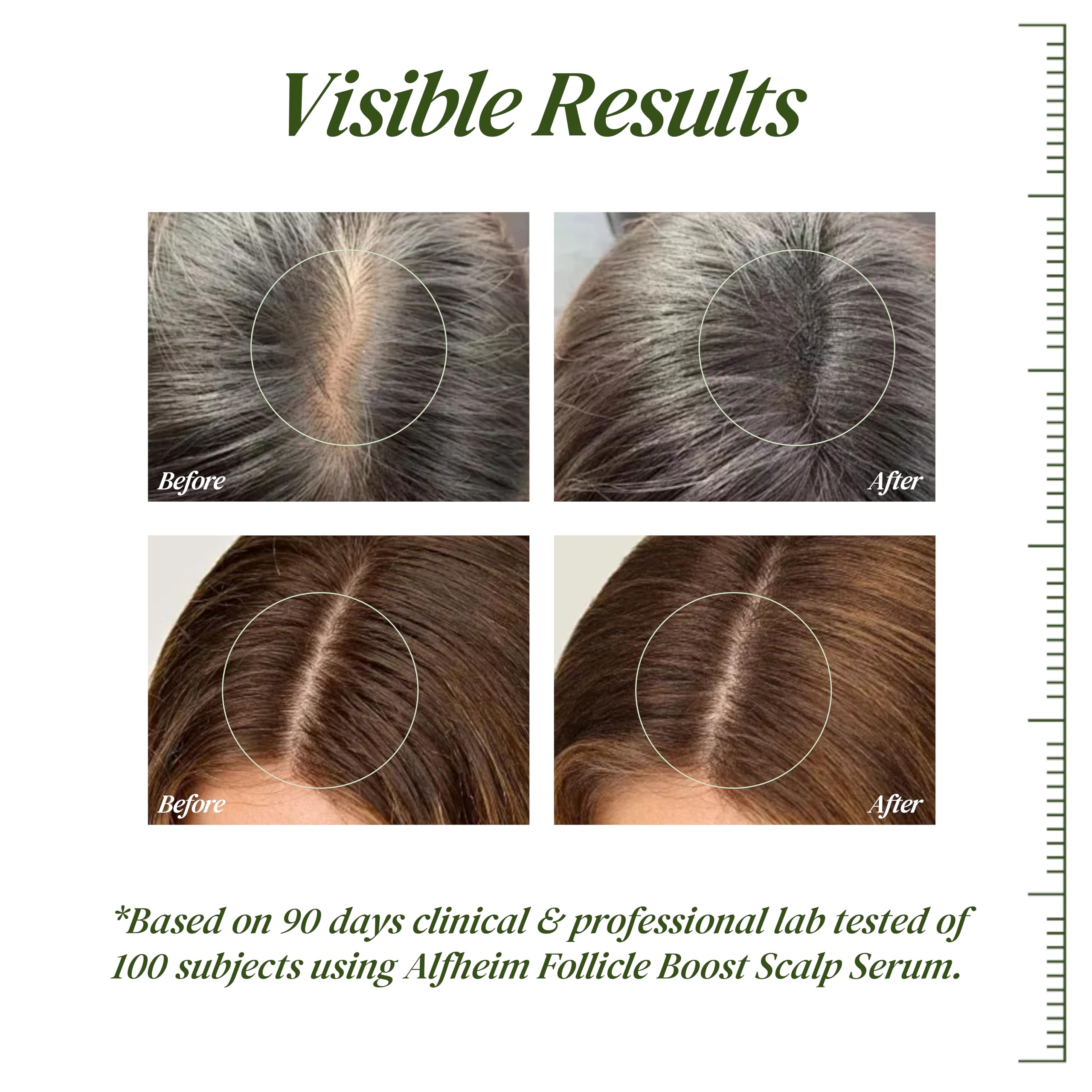 ALFHEIM Saw Palmetto Scalp Serum for Thicker Hair – Caffeine, Biotin, 1.69 fl oz + Serum Applicator