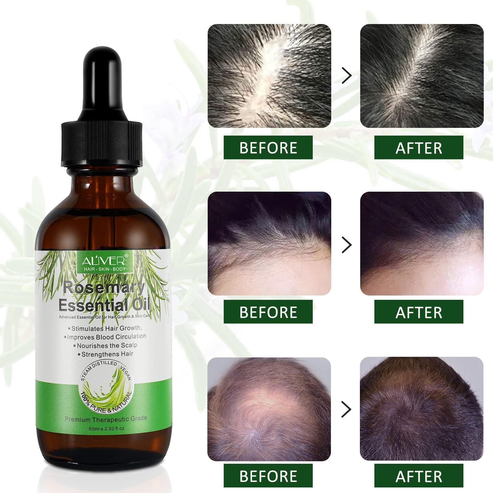 ALIVER Pure Rosemary Essential Oil – 2-Pack for Hair & Scalp Care | 2.02 Fl Oz