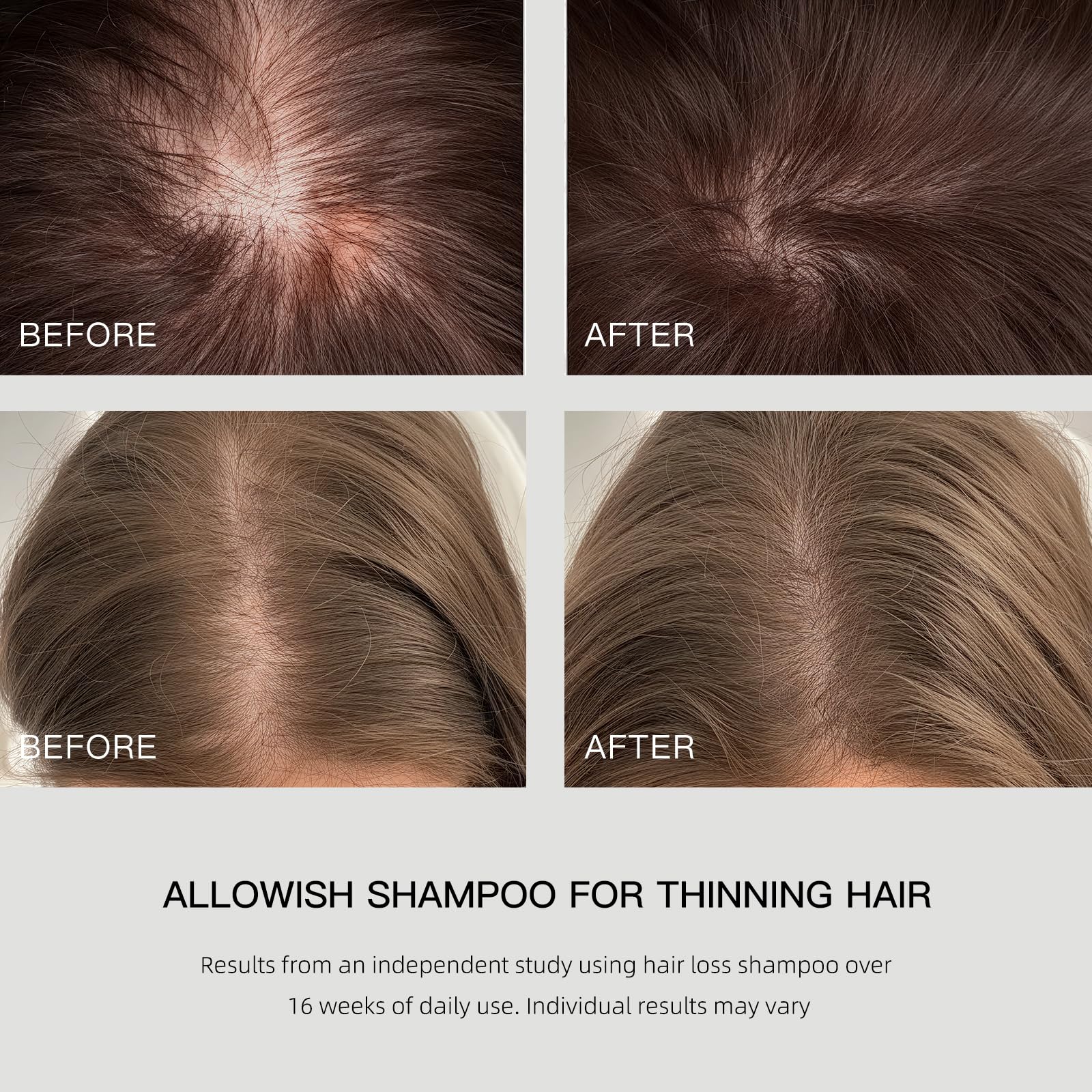 ALLOWISH Hair Loss Shampoo with Biotin, Ginger & Rosemary – Thickening & Hydrating