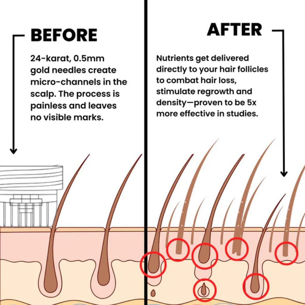AlphainFuze Hair Regrowth System – Advanced Growth Treatment