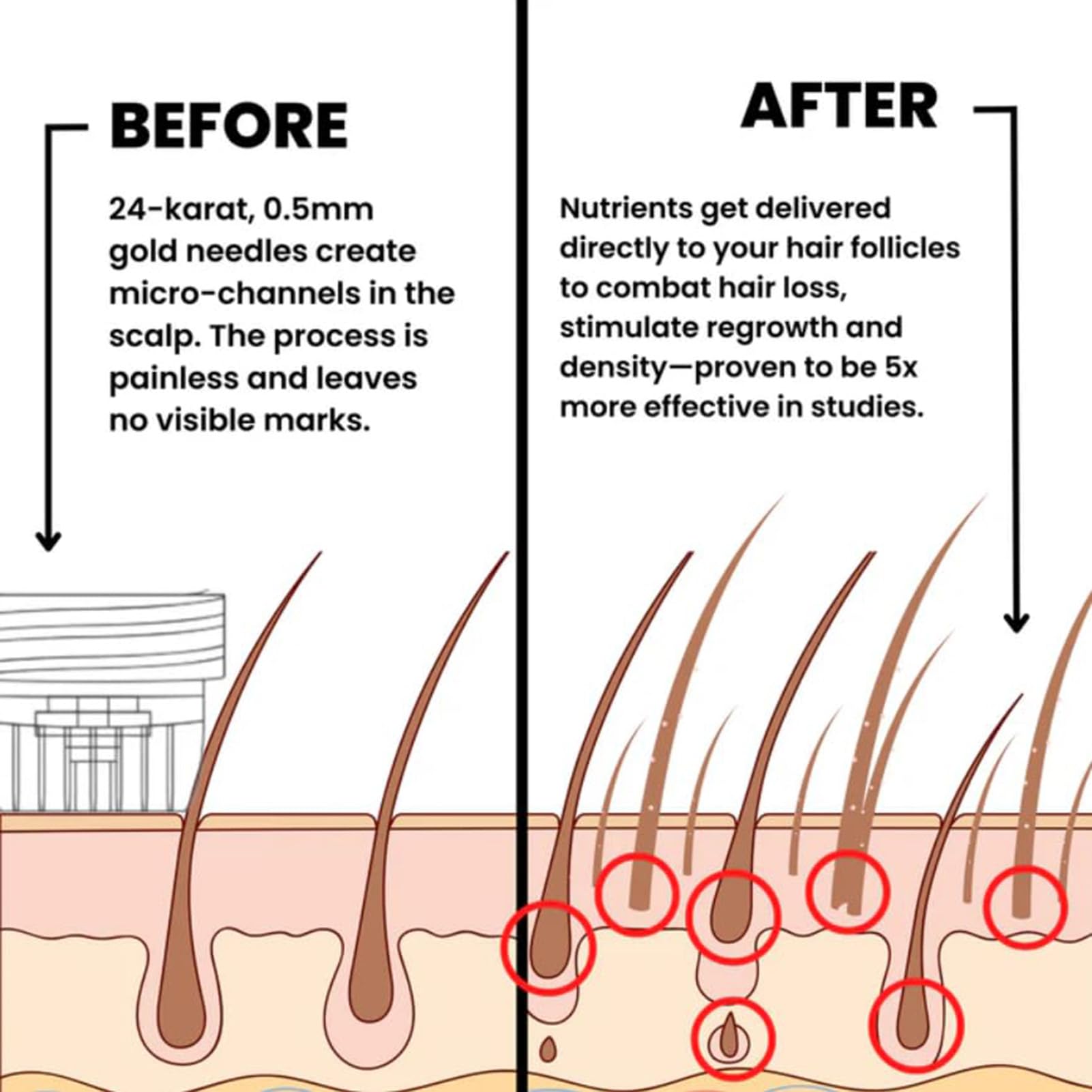 AlphainFuze Hair Regrowth System – Advanced Growth Treatment