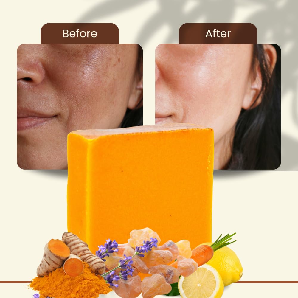 Ammoya Naturals Turmeric Skin Cleansing Soap - Face & Body Cleanser for All Skin Types