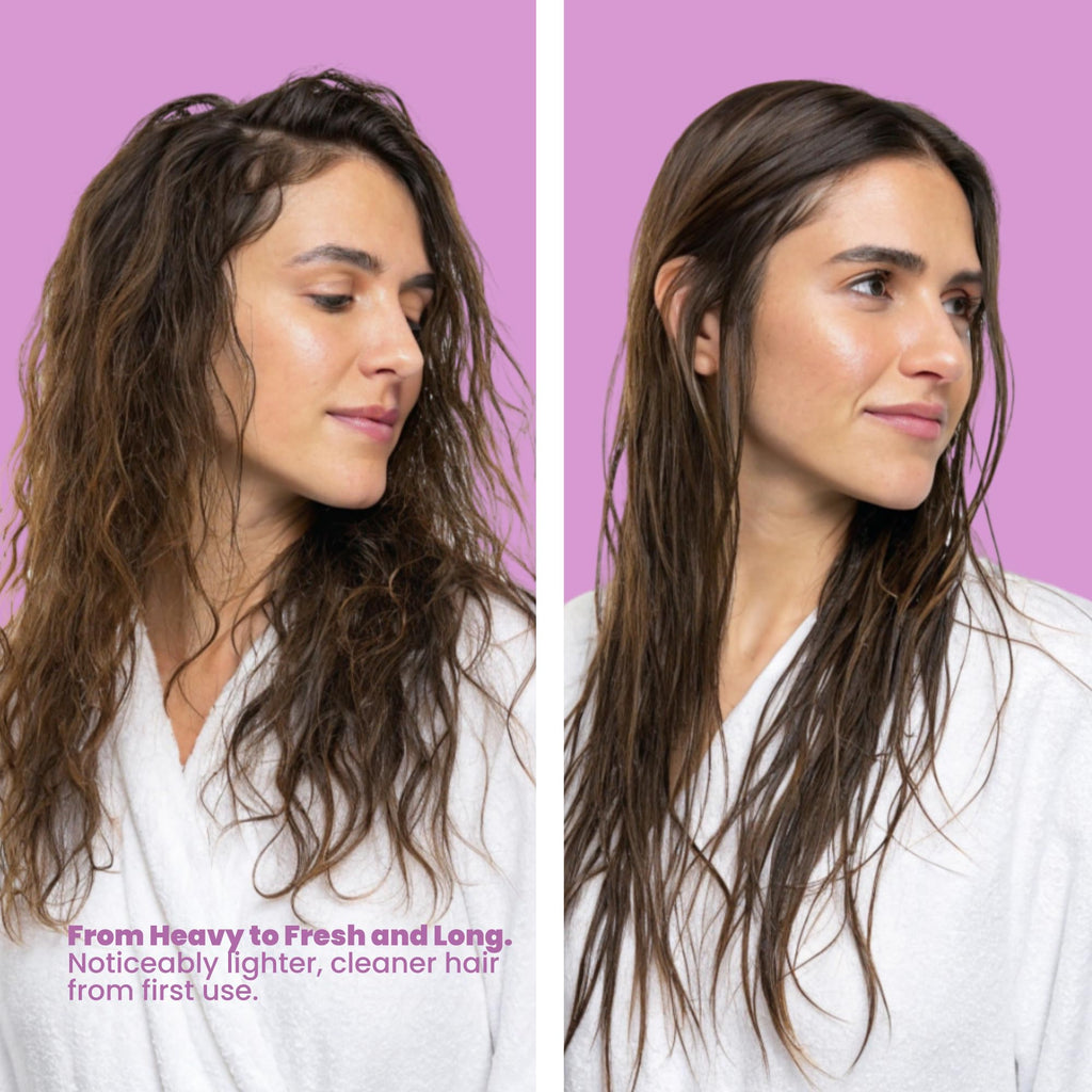 ANYELUZ Onion Shampoo, Conditioner & Hair Mask Set – Oil Control, Color Protection, Nourishment