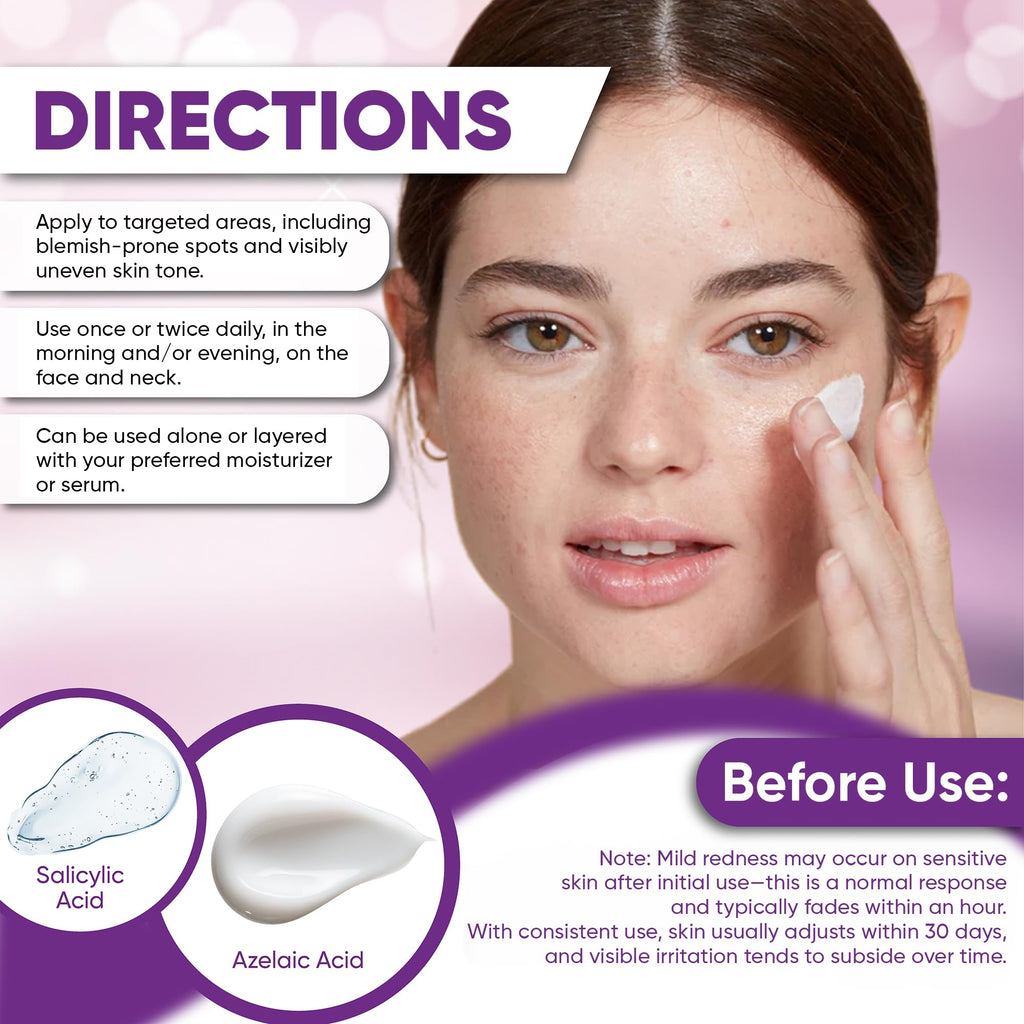 AOBBIY Azelaic Acid Cream for Face – Redness-Soothing, Even Tone, Pore Care (1 oz)