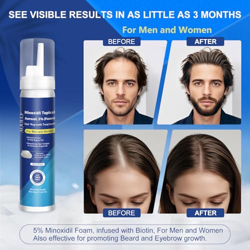 AOOLCF 5% Minoxidil Foam with Biotin – Hair Growth Treatment for Men and Women, 6.33 oz (3-Month Supply)