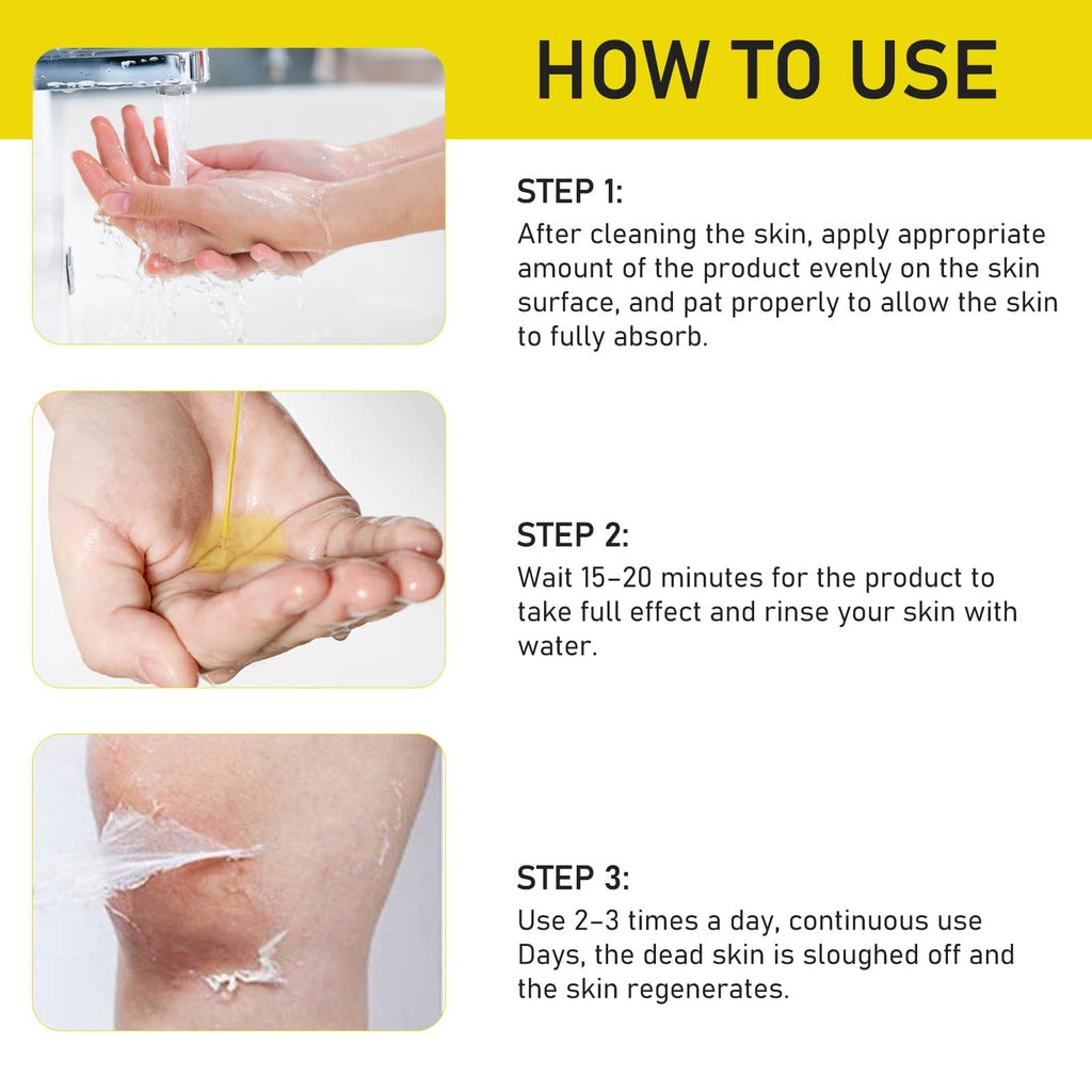 AOPEIBOTO Yellow Peeling Oil for Dark Skin — Extra Strong Body & Hand Exfoliant, 3.38 fl oz