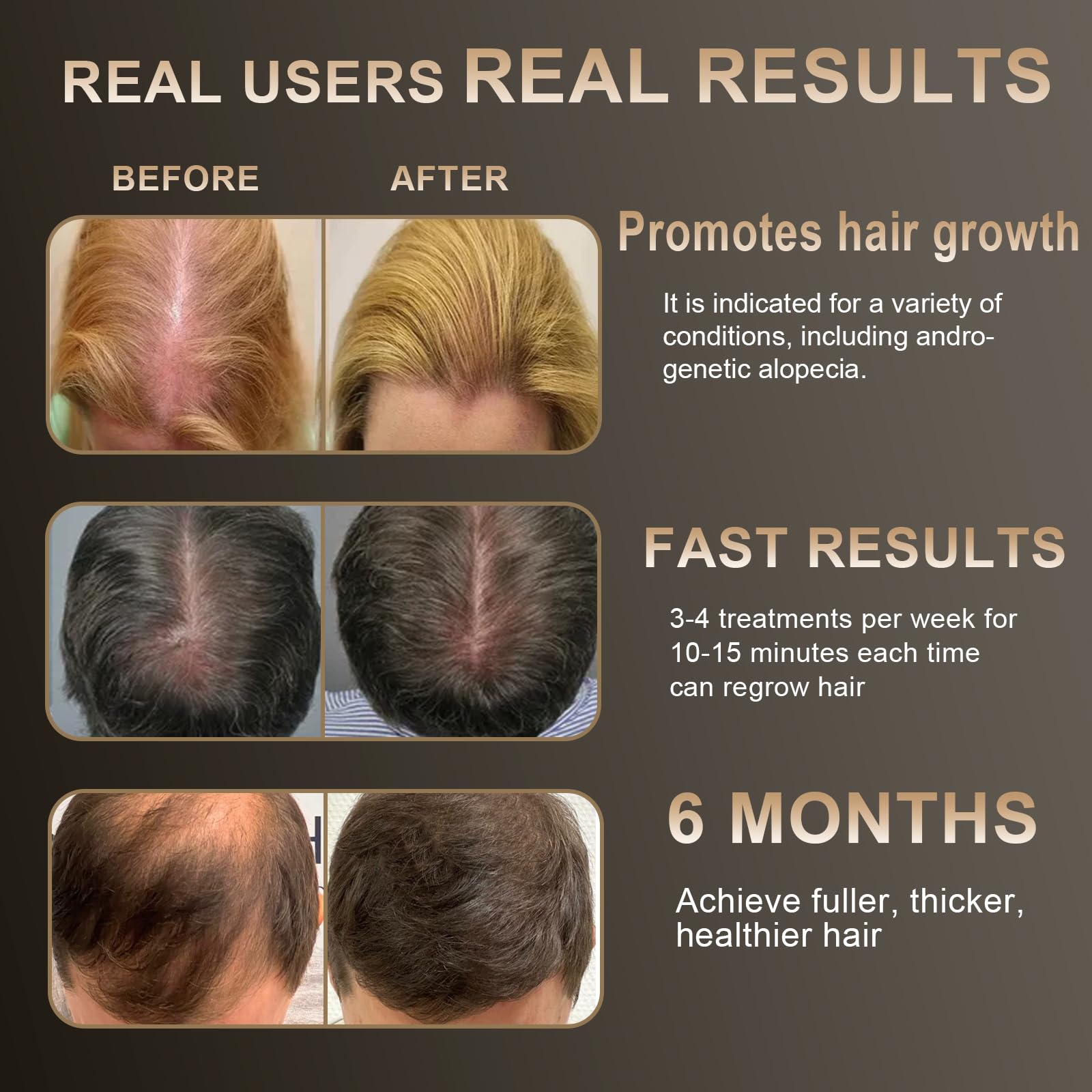 Apbier Laser Hair Growth Comb – Gentle Light Therapy for Hair Growth Support (Men & Women)