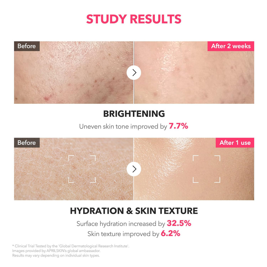 APRILSKIN TXA+Niacinamide 99 Pink Milky Toner – 99% TXA + Niacinamide 5% for Brightening, Deep Hydration | 5.07 fl oz