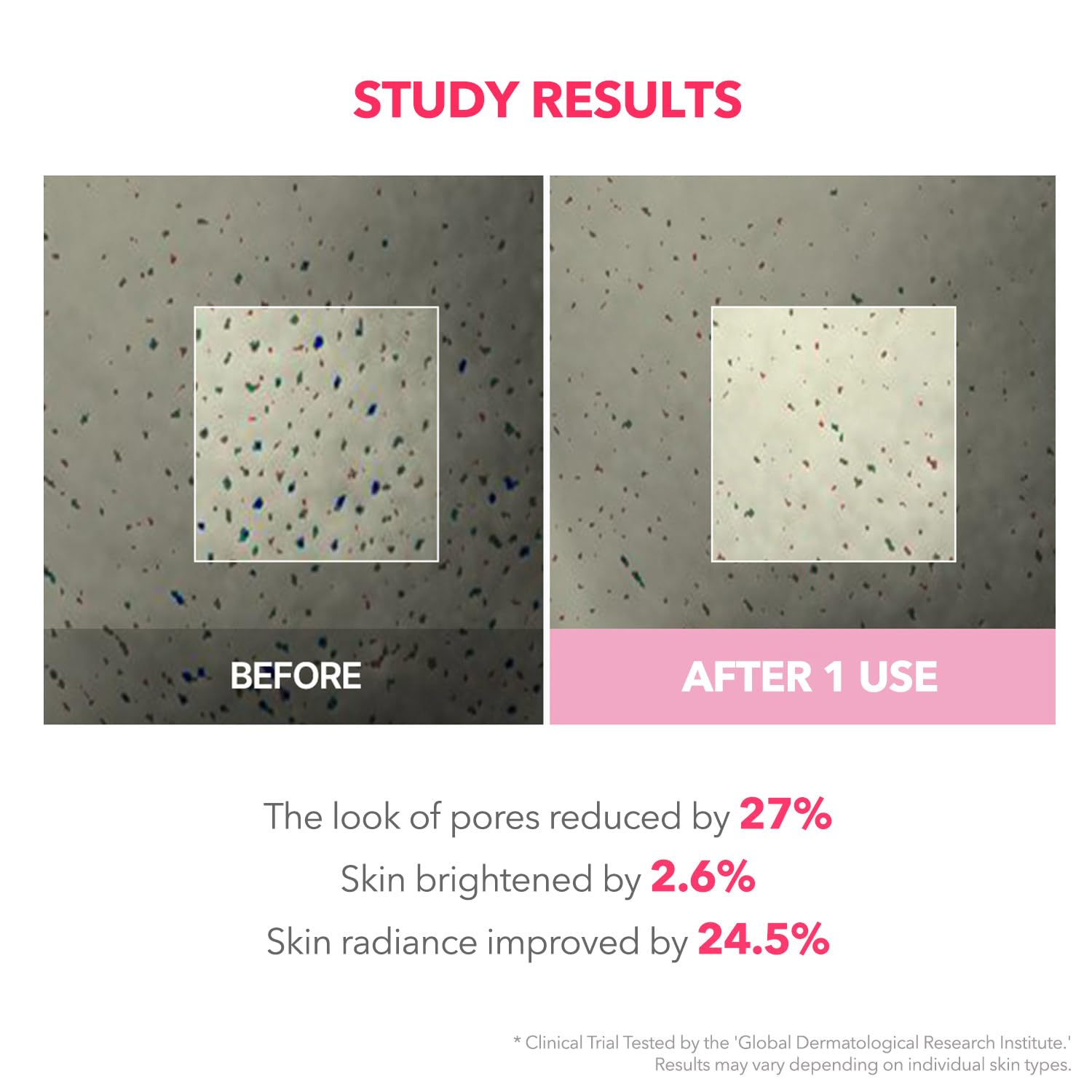 APRILSKIN TXA Niacinamide 99 Overnight Wrapping Mask | 8-Hour Toning, Firming & Pore Care