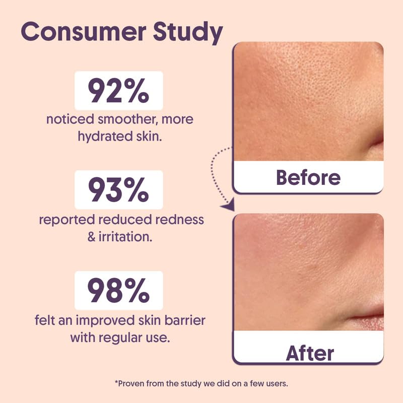 Aravi Organic Advanced Barrier Repair Moisturizer | Ceramides, Peptide, Hyaluronic Acid & Cica – Deep Hydration (3.5 oz / 100 g)