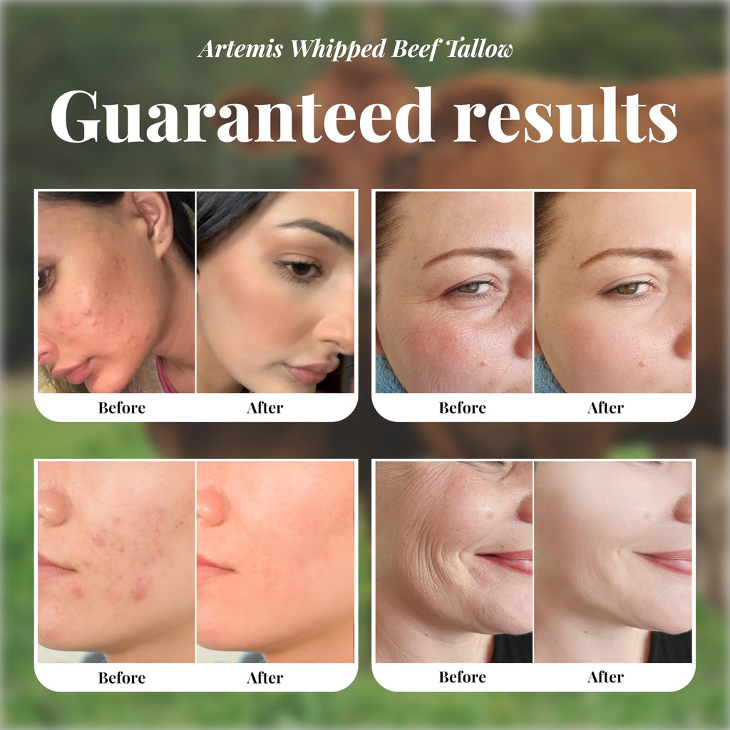 Artemis Beef Tallow Balm for Skin – Grass-Fed Moisturizer, 6 oz