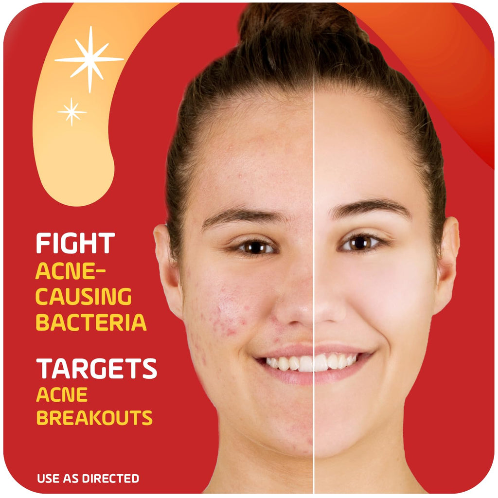 Asepxia 2% Salicylic Acid Acne Spot Treatment Cream | Drying Formula for Clearer Skin, 1 oz, 1-Pack