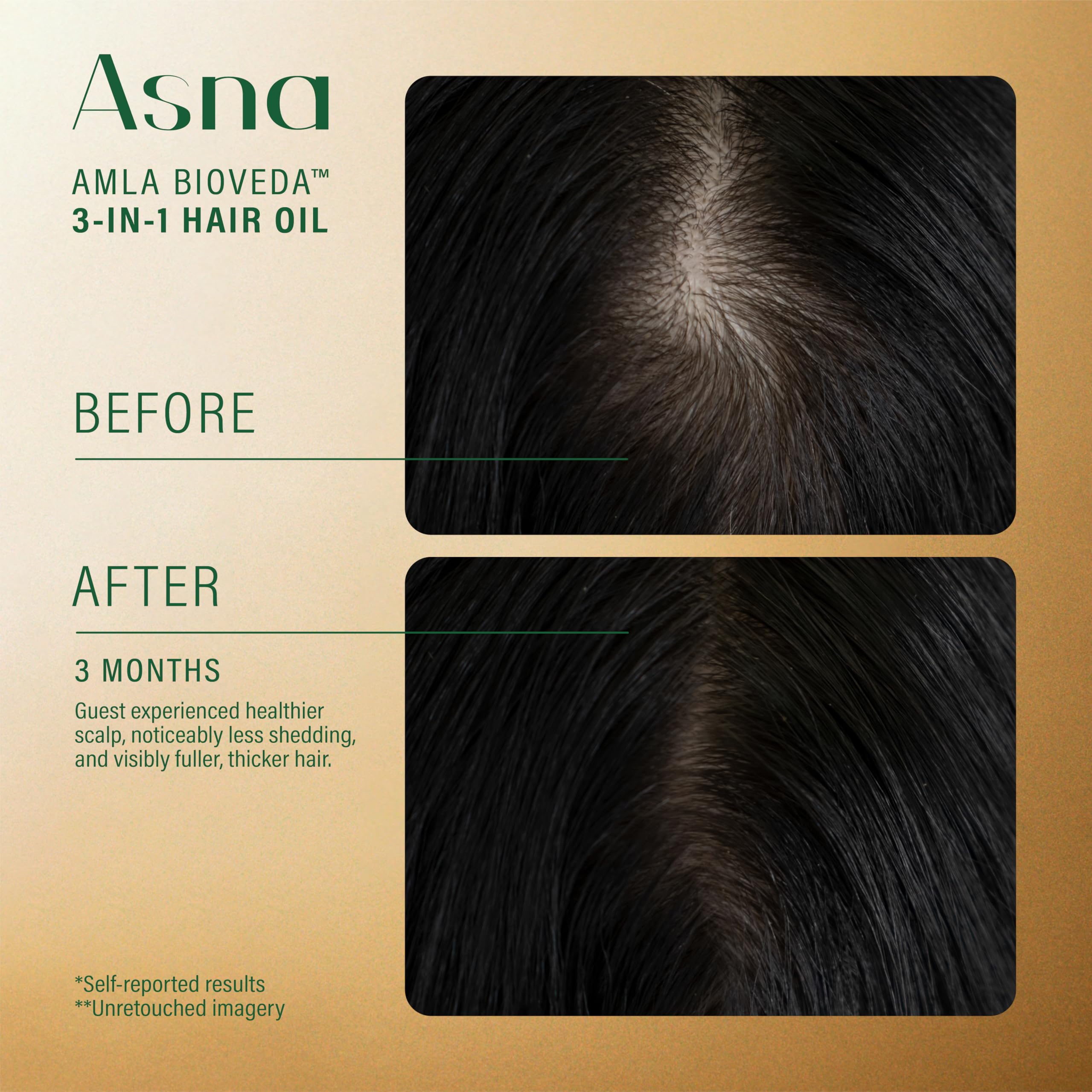 Asna Amla BioVeda 3-in-1 Hair Oil – Organic Hair & Scalp Serum with Bond Complex
