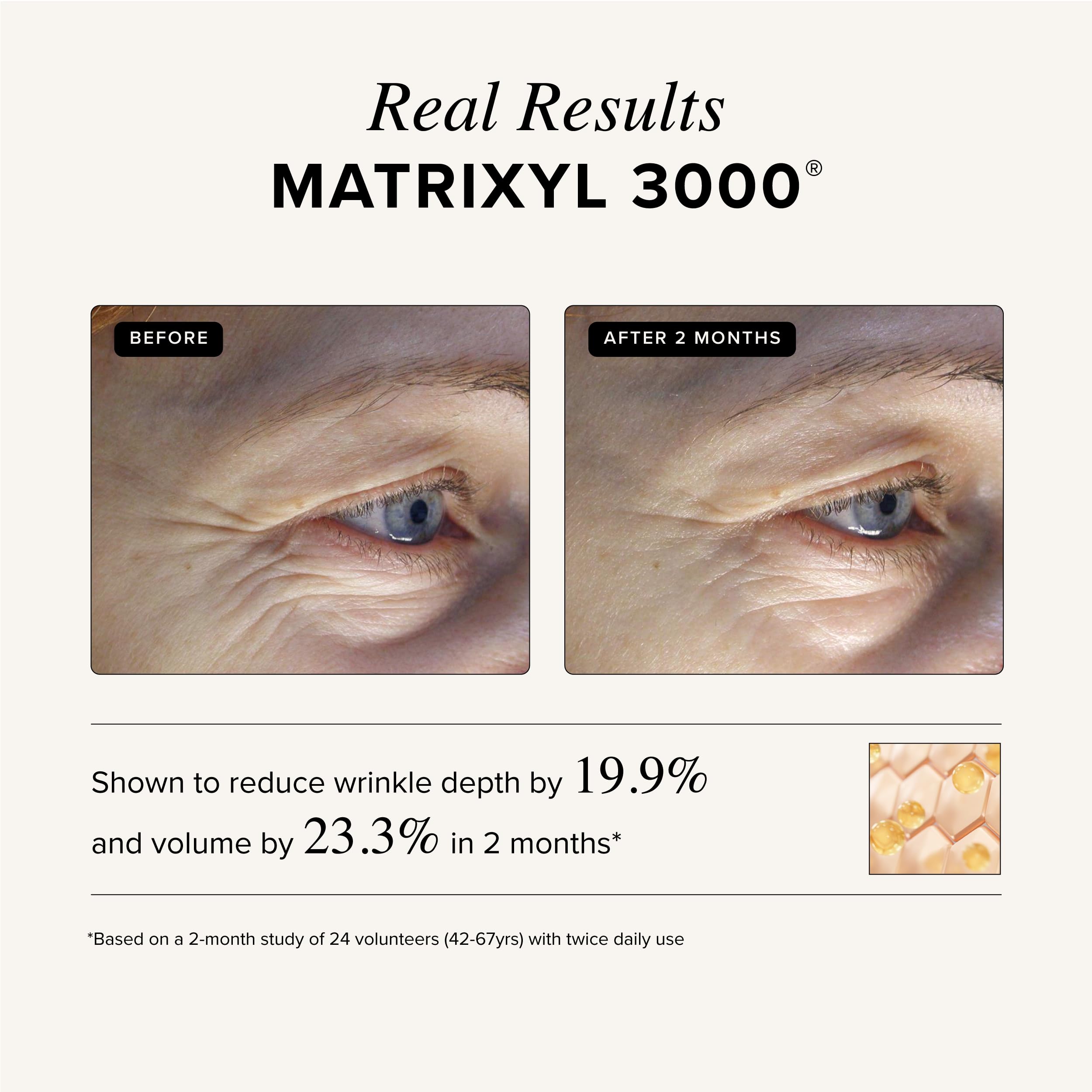 Asterwood Triple Repair Serum | Matrixyl 3000 + Argireline + Vitamin C + Hyaluronic Acid (Fragrance-Free) – 4 Fl Oz