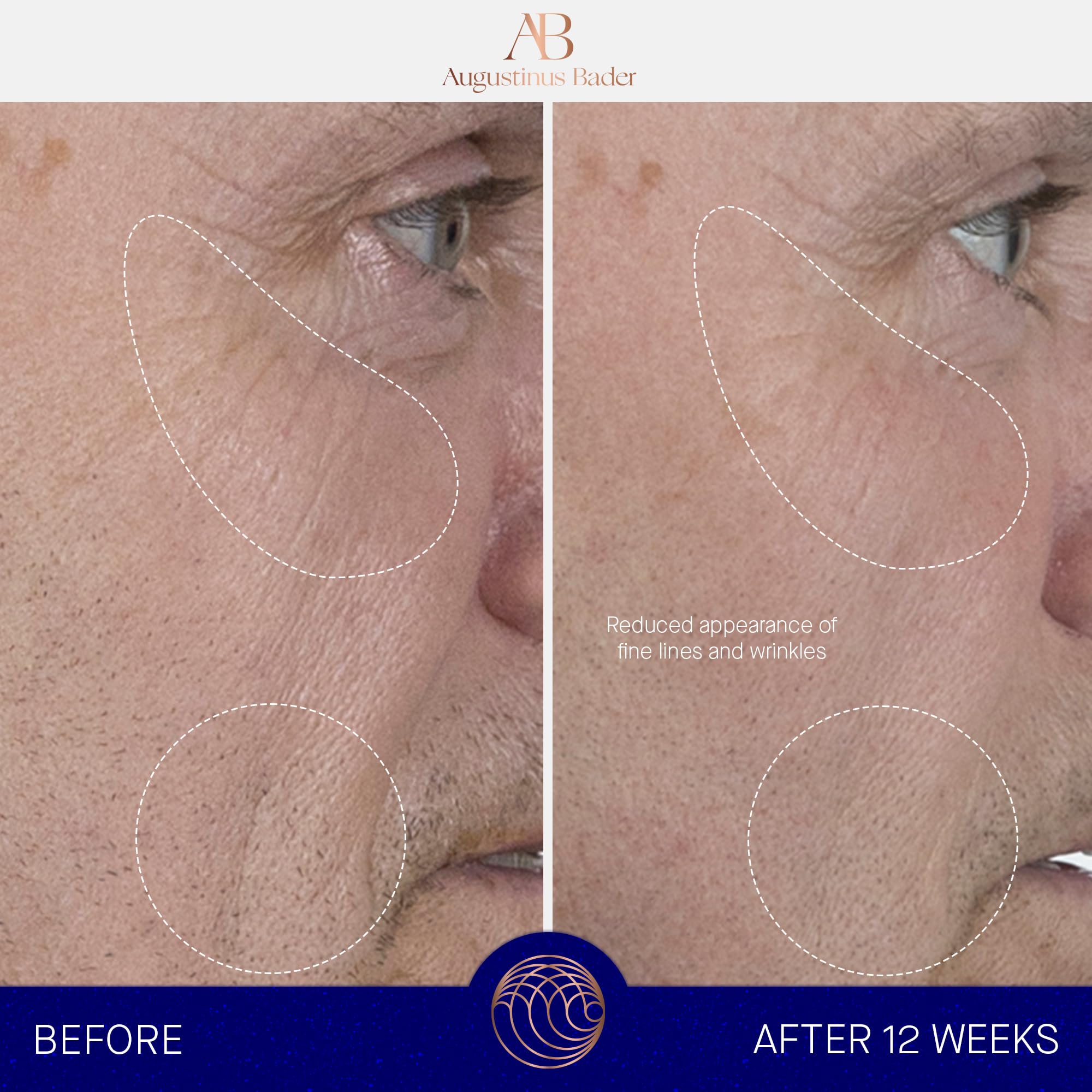 Augustinus Bader The Serum – Luxury Hydrating Anti‑Aging Serum