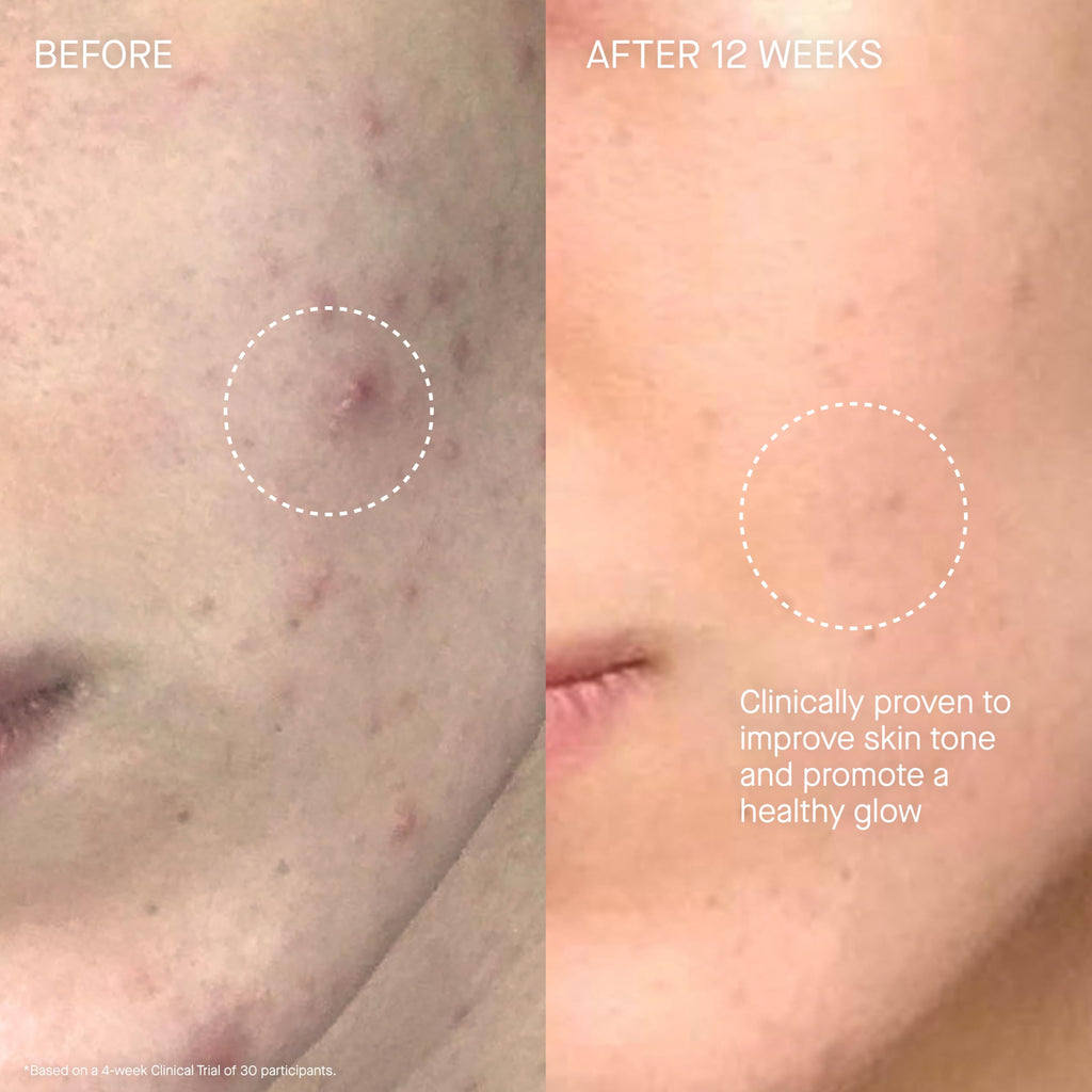 Augustinus Bader The Cream – Luxury Hydrating Face Moisturizer | TFC8®