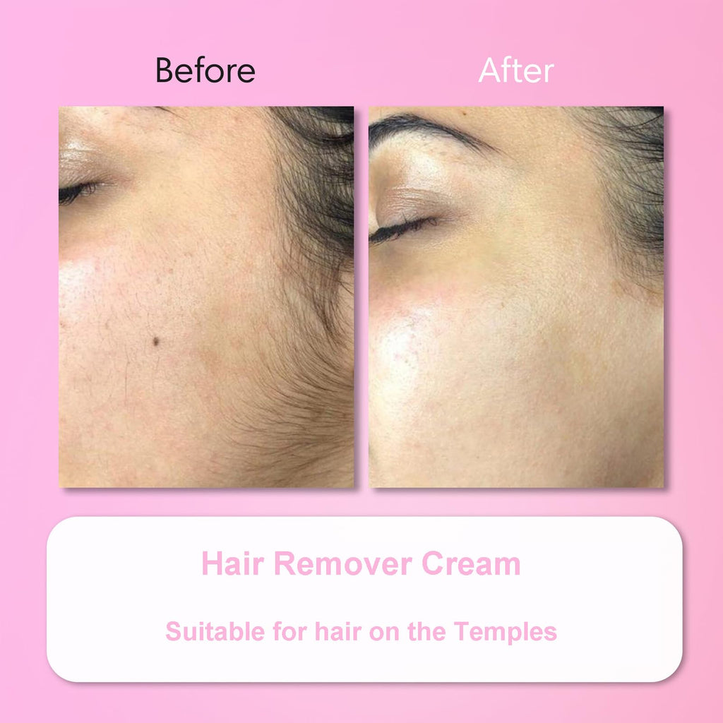 Aurlux Hair Remover Cream for Face – 15-Minute Facial Hair Removal Kit