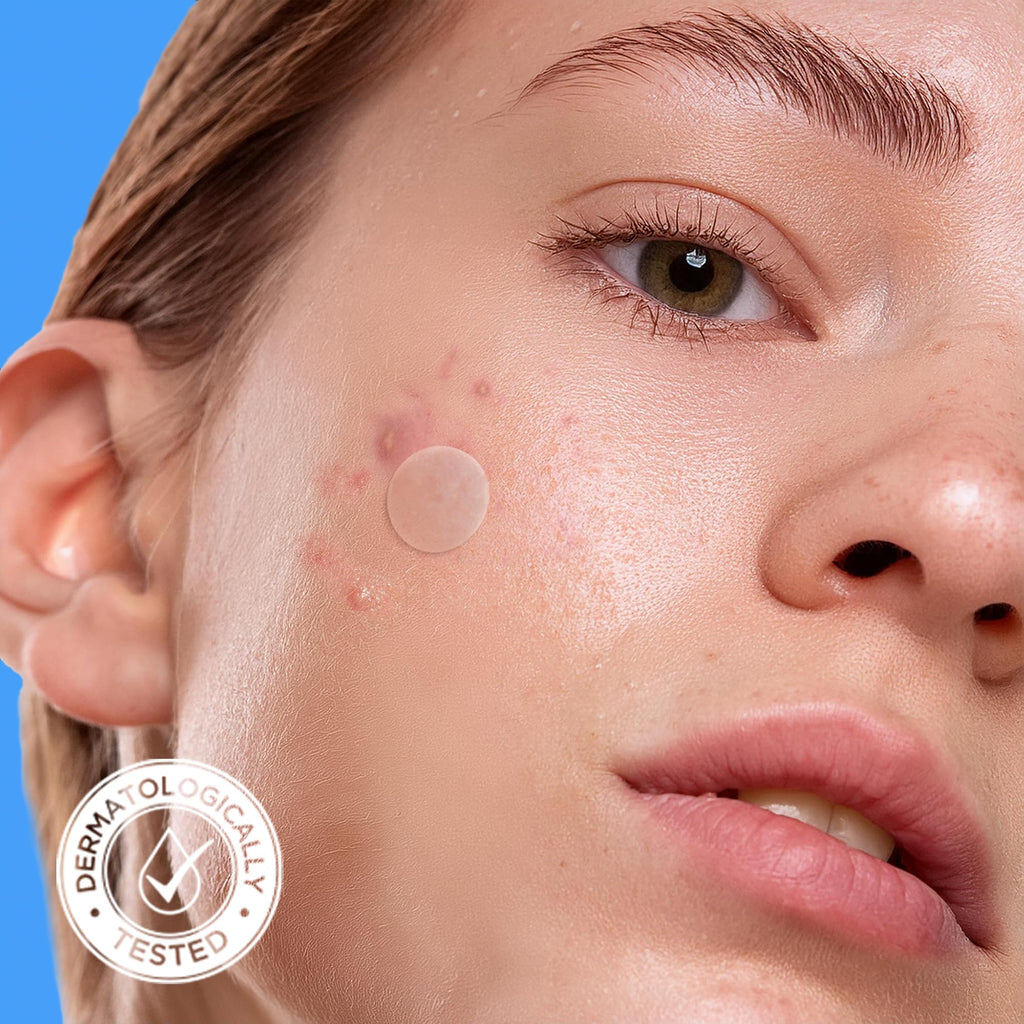 AVARELLE Pimple Patches for Face – Hydrocolloid Acne Patches with Tea Tree, Calendula & Cica | FSA/HSA Eligible Bulk Pack (300 ct, 10–14 mm)