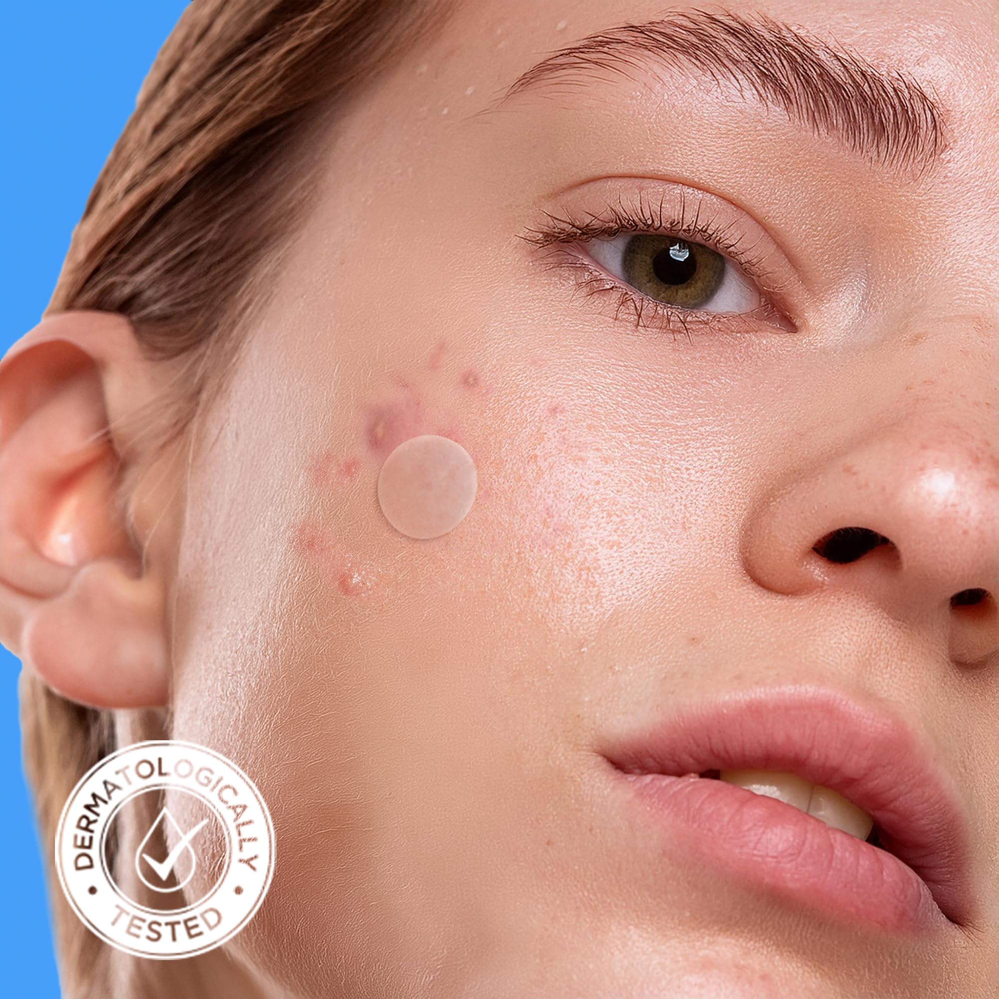 AVARELLE Pimple Patches for Face – Hydrocolloid Acne Patches with Tea Tree, Calendula & Cica | FSA/HSA Eligible Bulk Pack (300 ct, 10–14 mm)